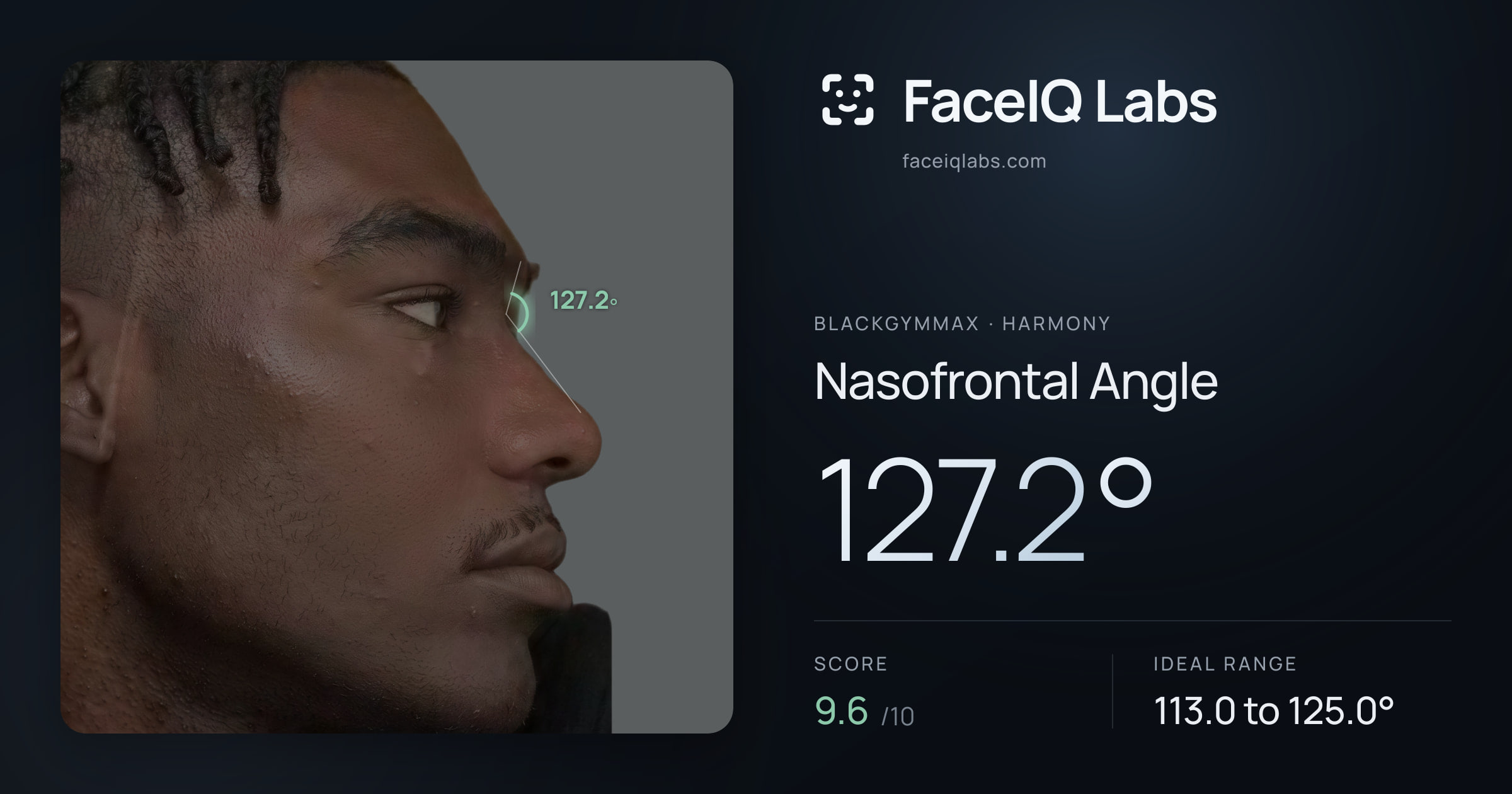Blackgymmax Nasofrontal Angle: 127.2°, drawn on the photo
