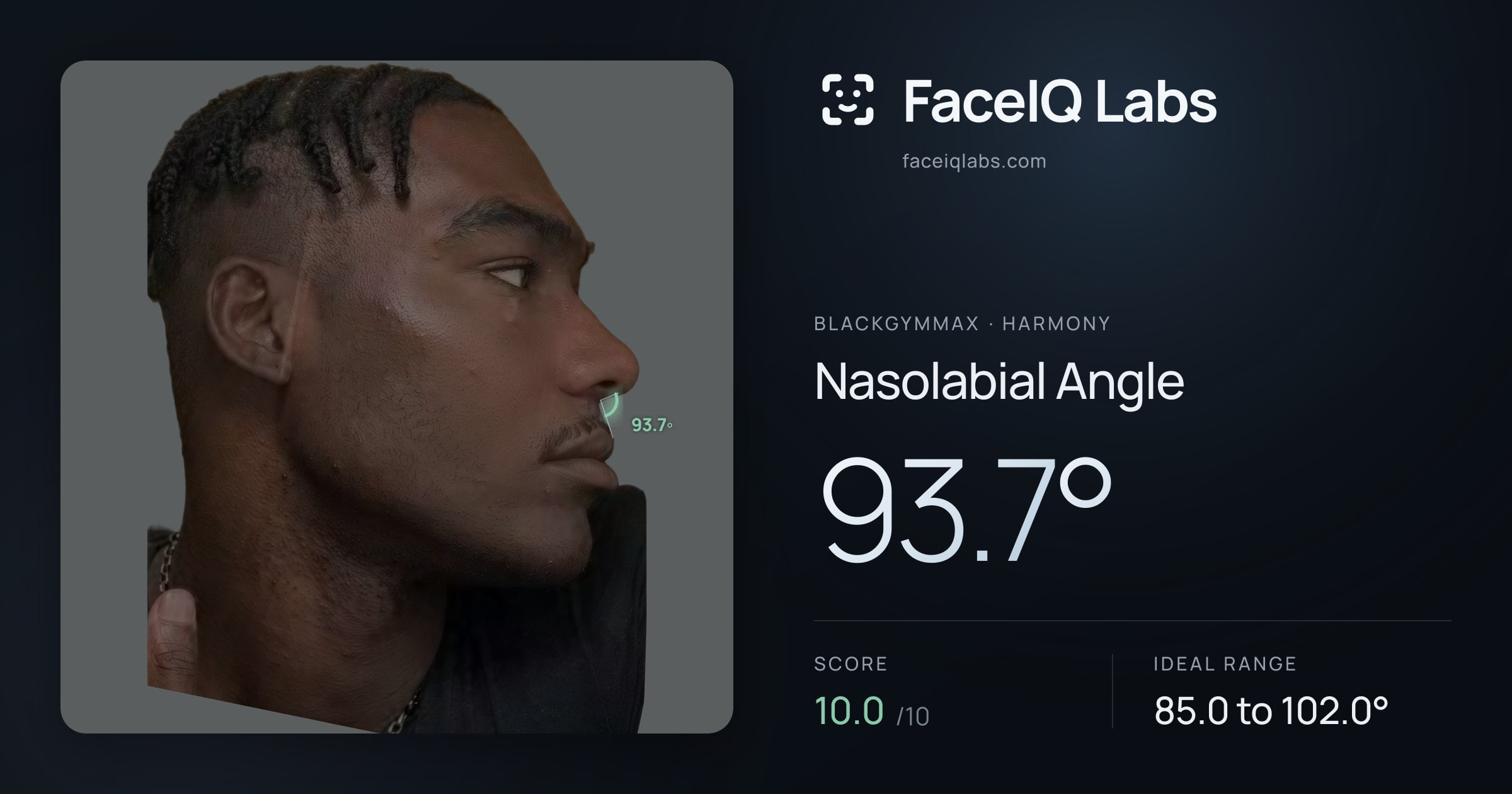 Blackgymmax Nasolabial Angle: 93.7°, drawn on the photo