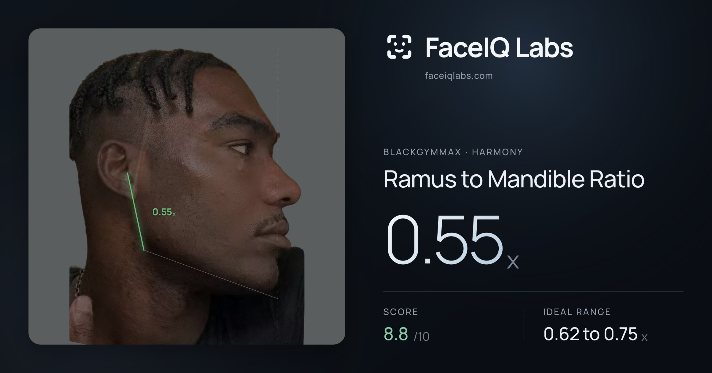 Blackgymmax Ramus to Mandible Ratio: 0.55x, drawn on the photo