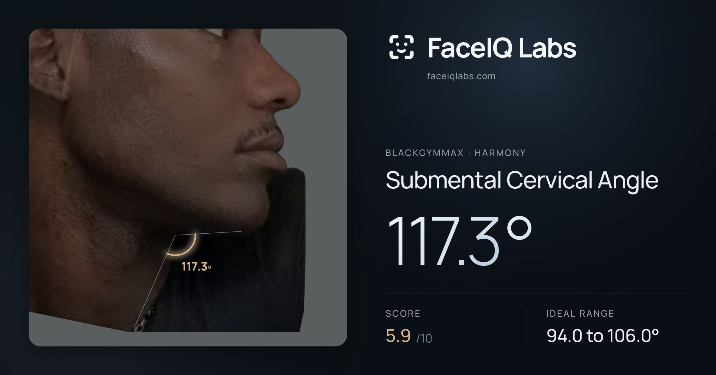 Blackgymmax Submental Cervical Angle: 117.3°, drawn on the photo