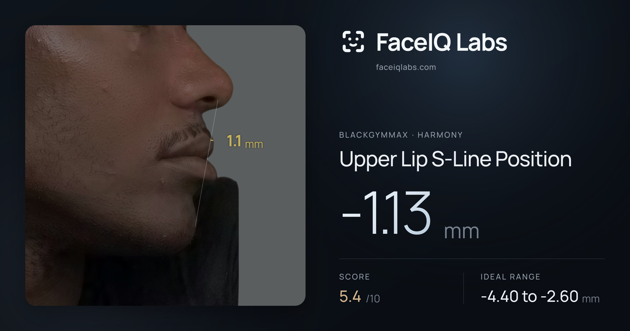 Blackgymmax Upper Lip S-Line Position: -1.13mm, drawn on the photo