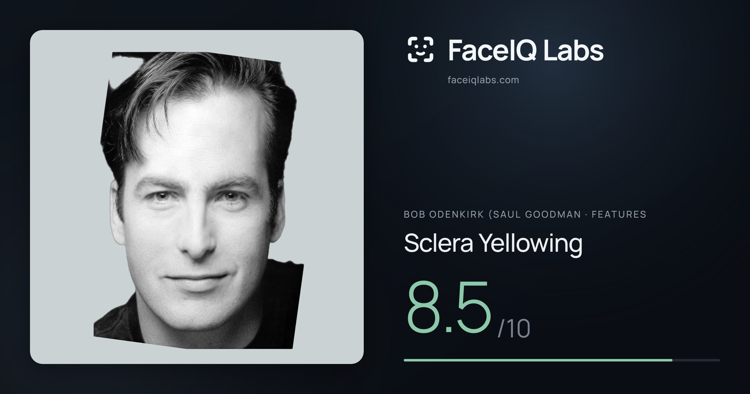 Bob Odenkirk (Saul Goodman Sclera Yellowing: 8.5/10, drawn on the photo