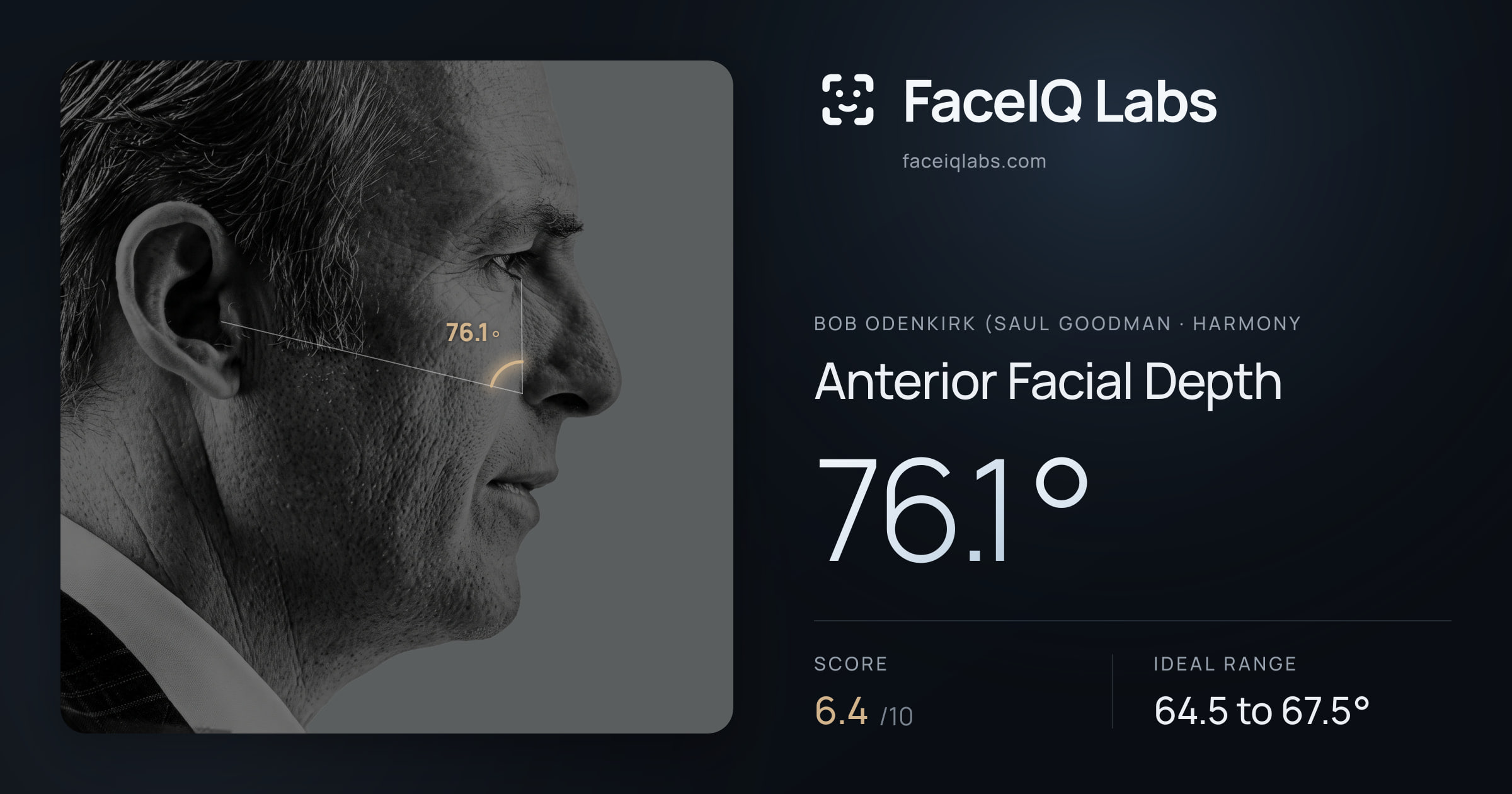 Bob Odenkirk (Saul Goodman Anterior Facial Depth: 76.1°, drawn on the photo