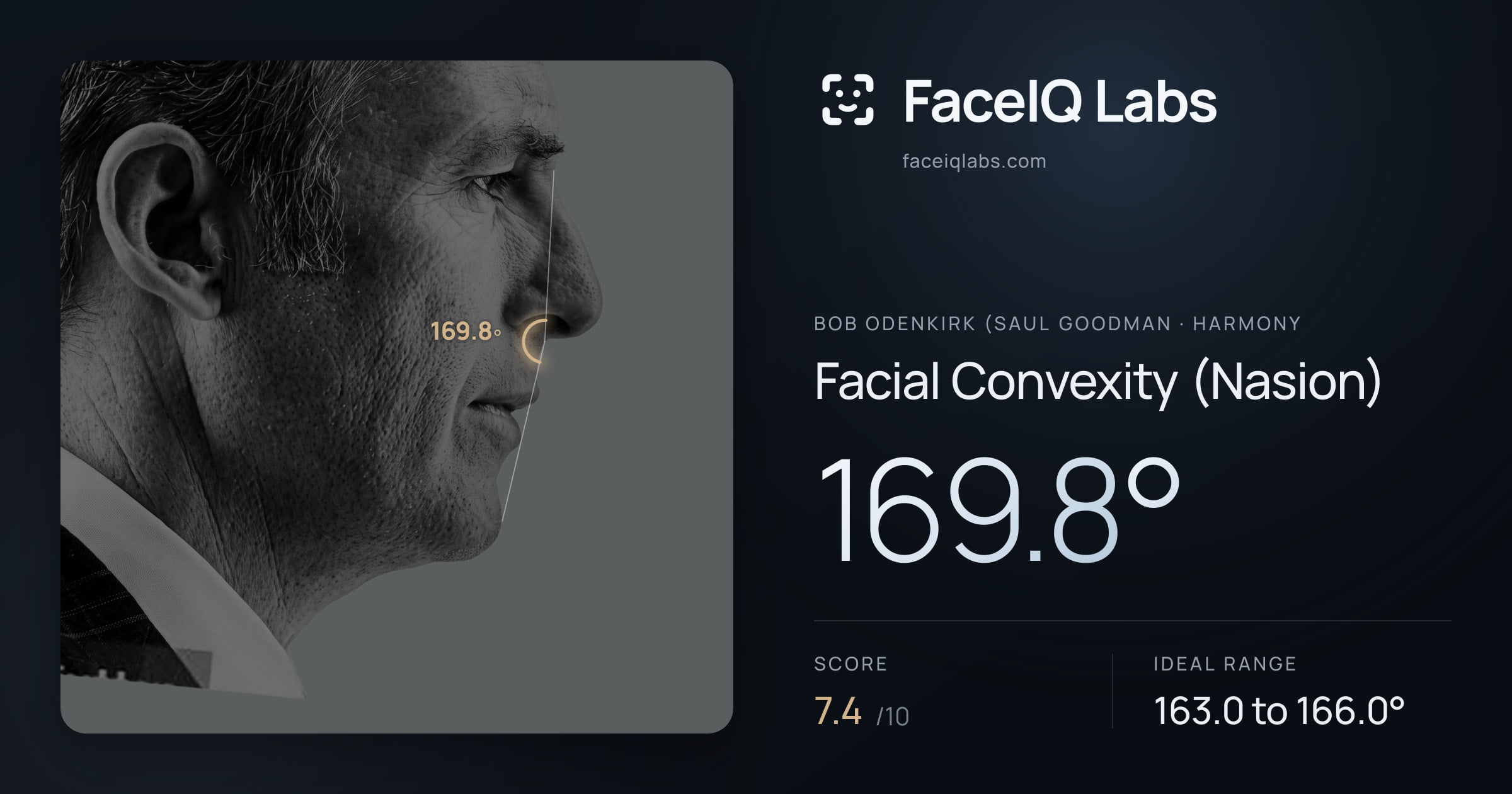 Bob Odenkirk (Saul Goodman Facial Convexity (Nasion): 169.8°, drawn on the photo