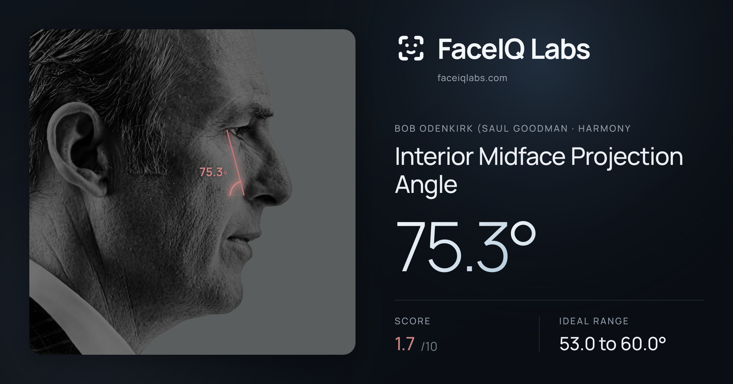 Bob Odenkirk (Saul Goodman Interior Midface Projection Angle: 75.3°, drawn on the photo