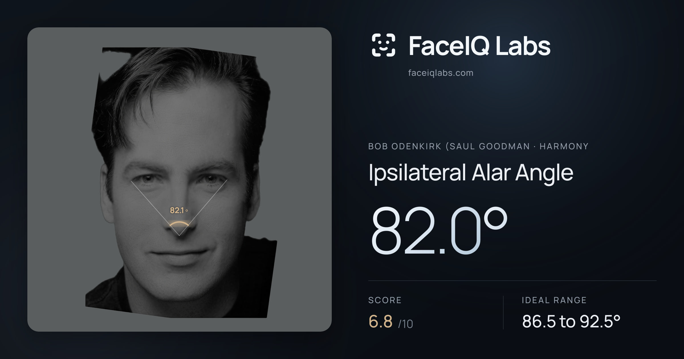 Bob Odenkirk (Saul Goodman Ipsilateral Alar Angle: 82.0°, drawn on the photo