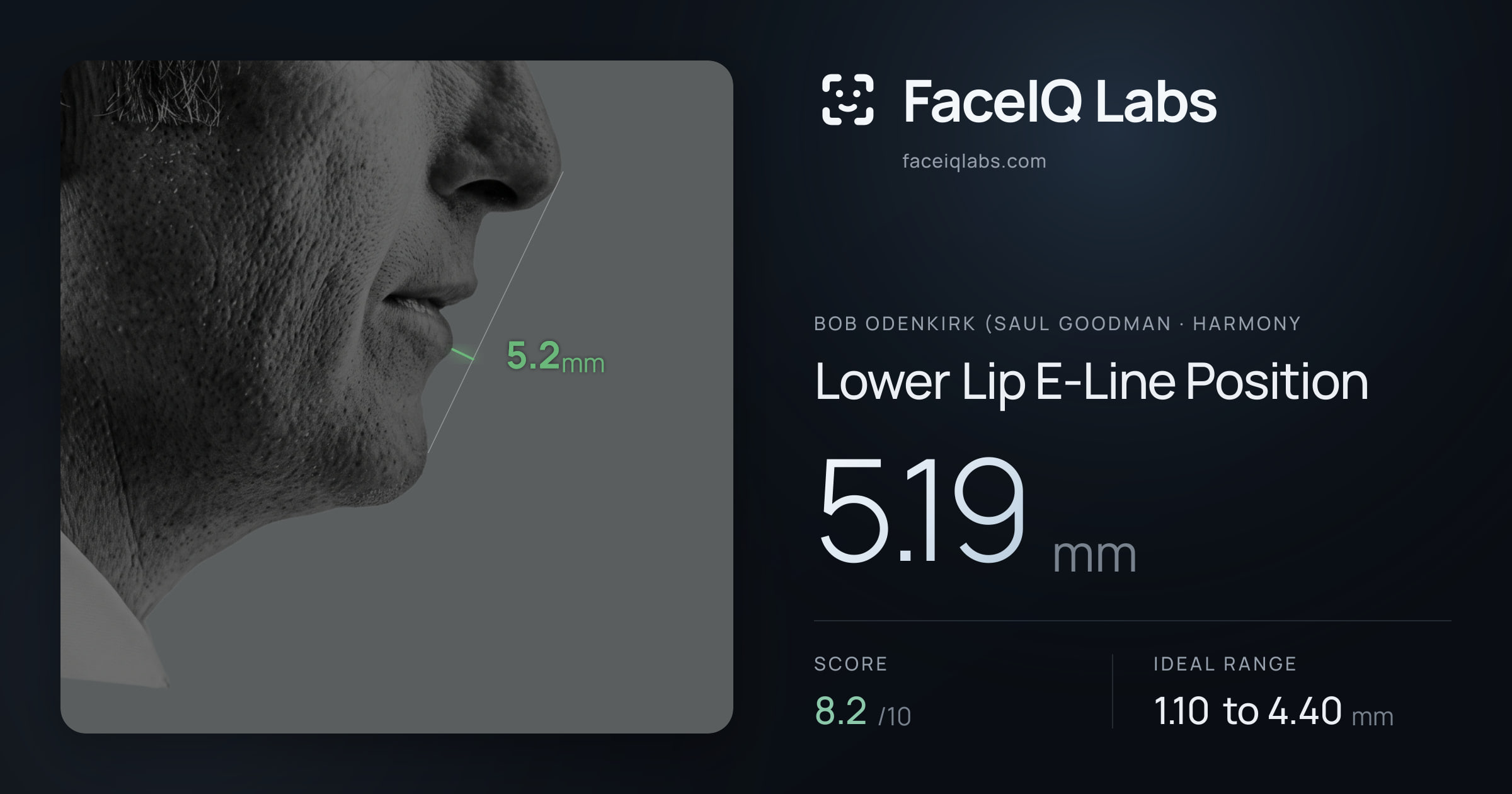Bob Odenkirk (Saul Goodman Lower Lip E-Line Position: 5.19mm, drawn on the photo