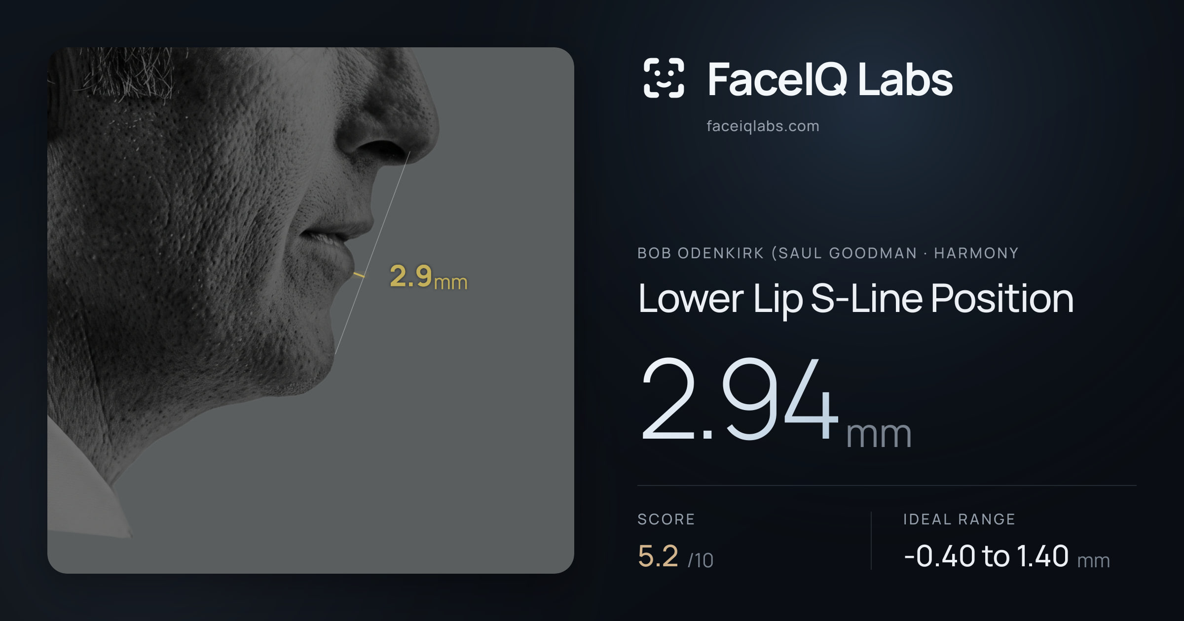 Bob Odenkirk (Saul Goodman Lower Lip S-Line Position: 2.94mm, drawn on the photo