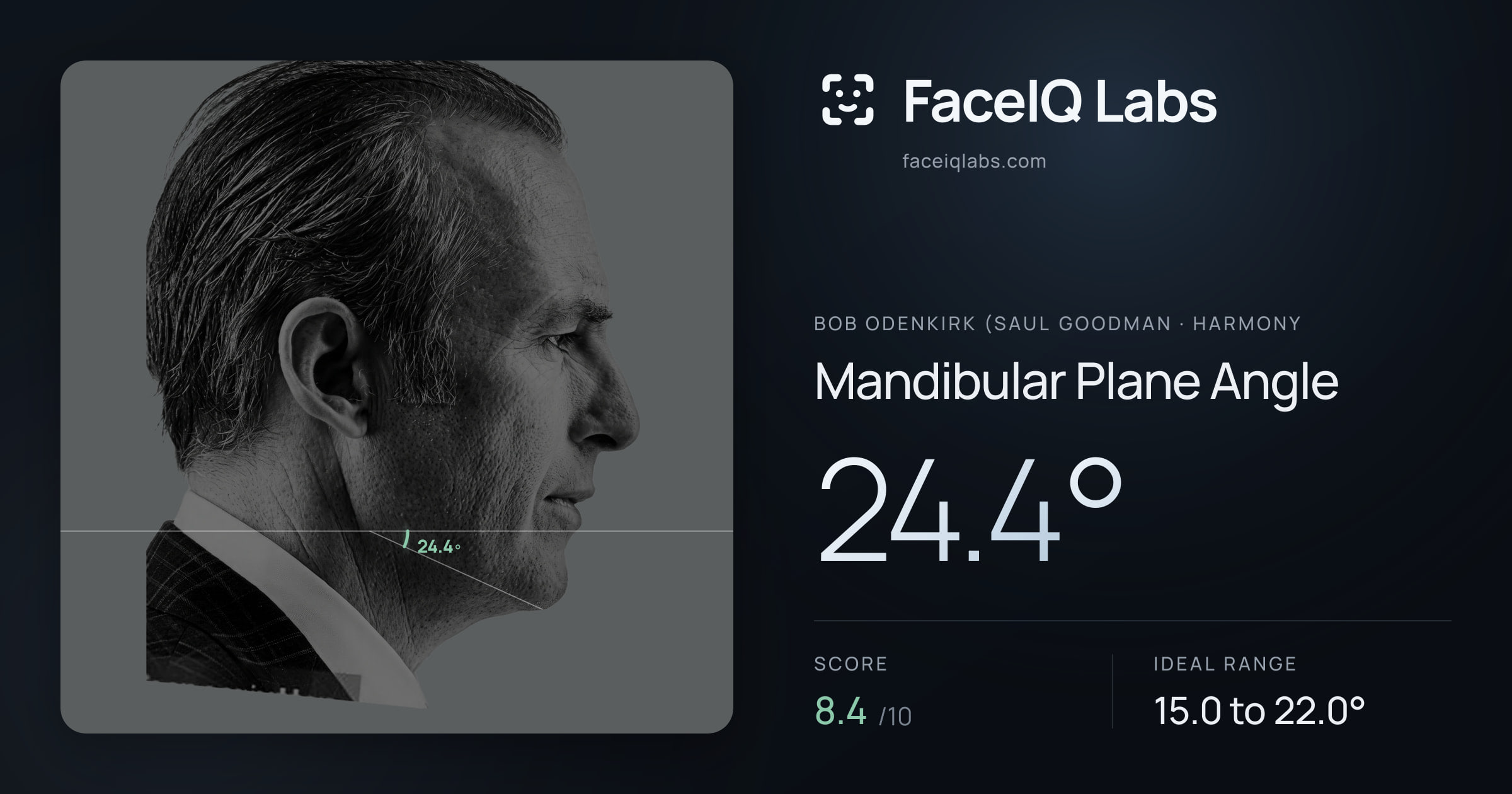 Bob Odenkirk (Saul Goodman Mandibular Plane Angle: 24.4°, drawn on the photo