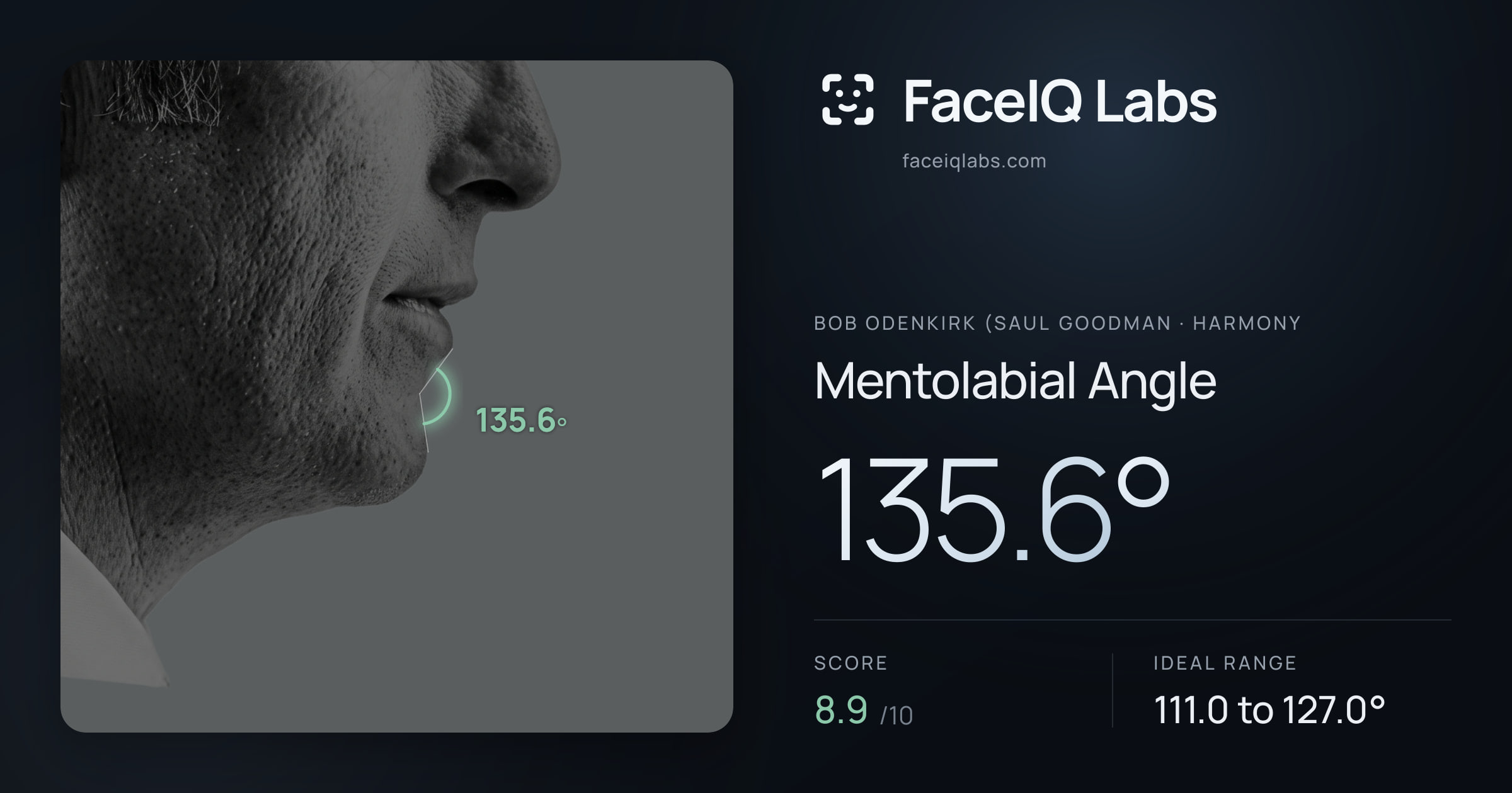 Bob Odenkirk (Saul Goodman Mentolabial Angle: 135.6°, drawn on the photo