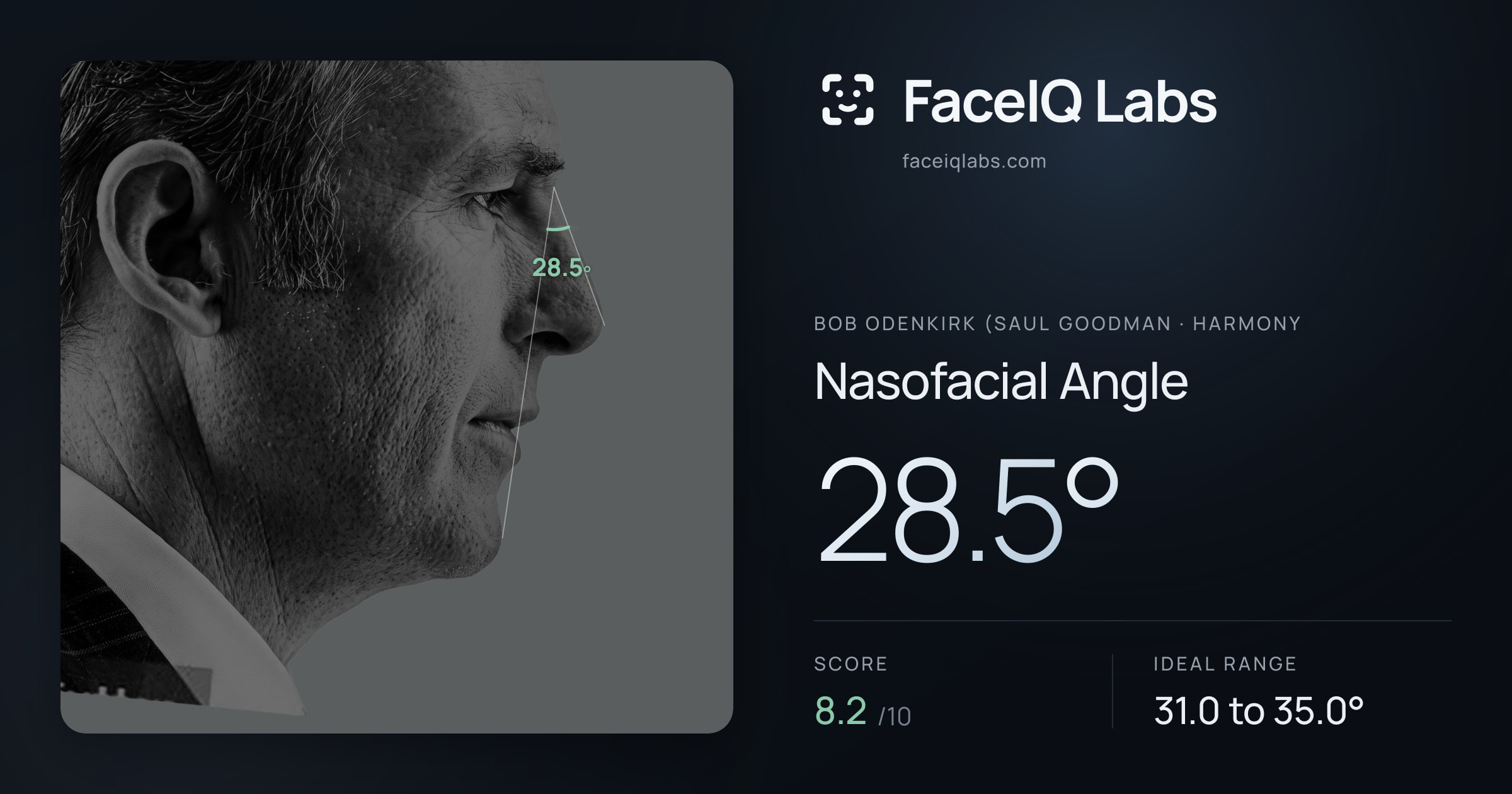 Bob Odenkirk (Saul Goodman Nasofacial Angle: 28.5°, drawn on the photo