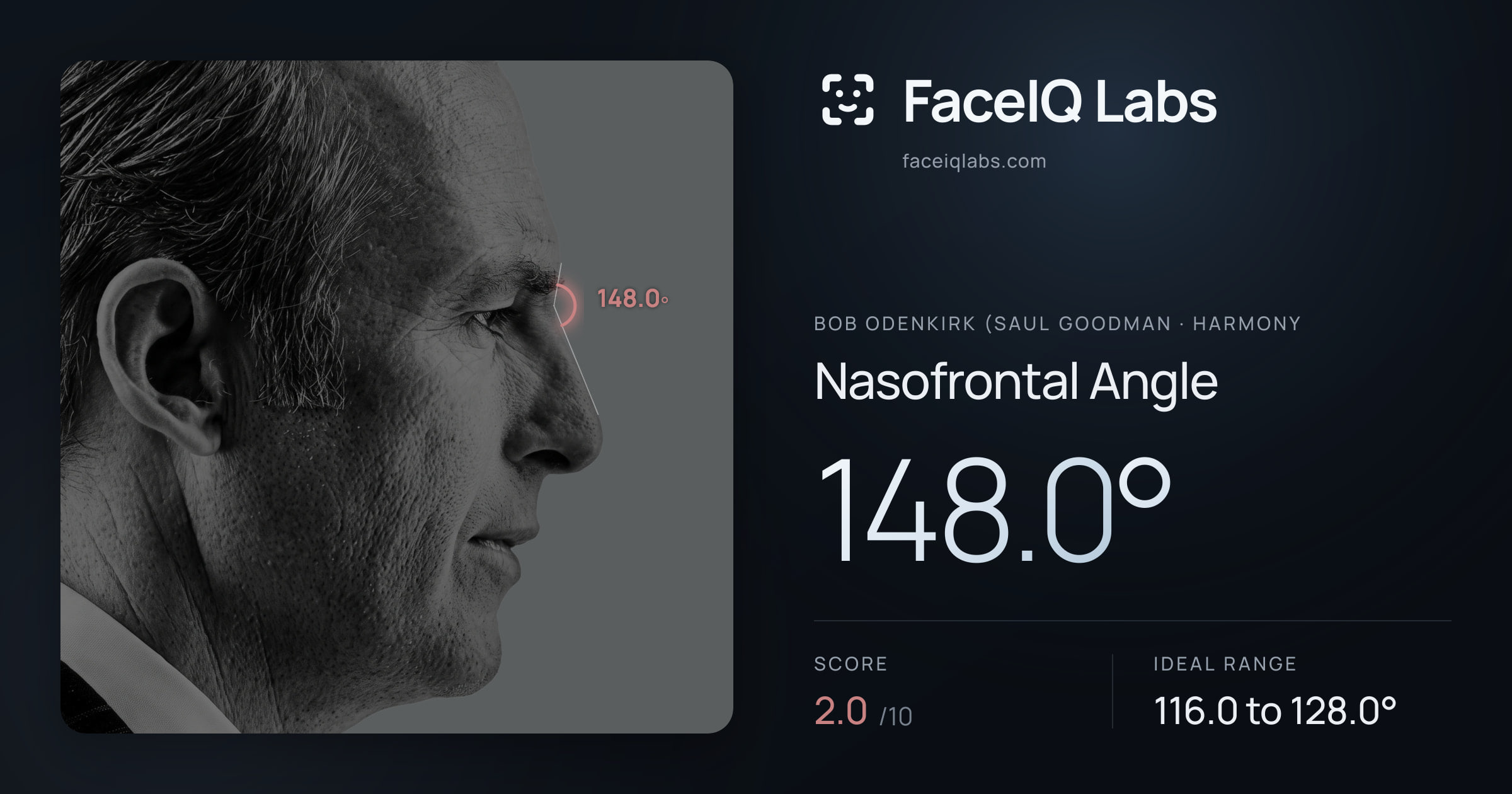 Bob Odenkirk (Saul Goodman Nasofrontal Angle: 148.0°, drawn on the photo