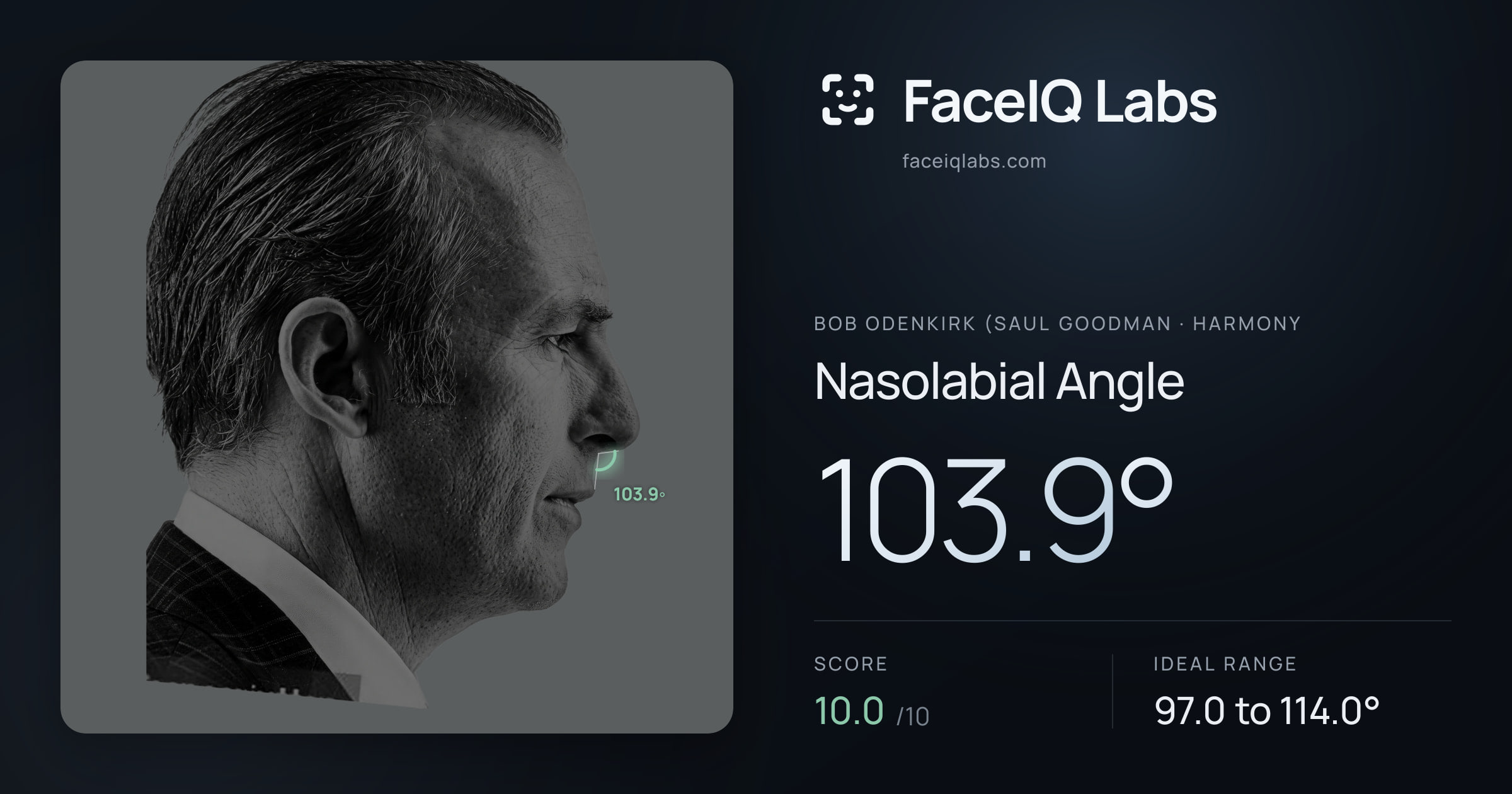 Bob Odenkirk (Saul Goodman Nasolabial Angle: 103.9°, drawn on the photo