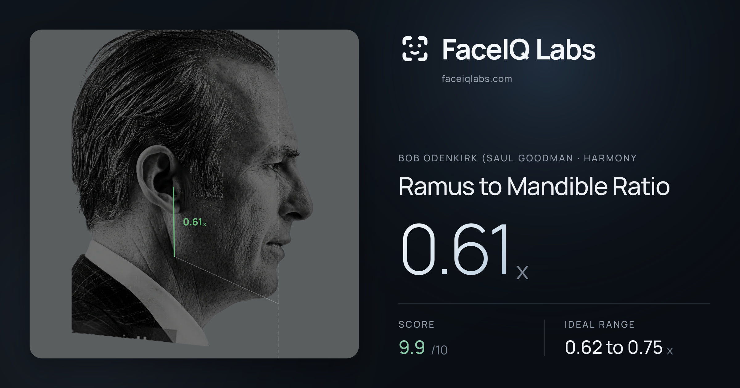 Bob Odenkirk (Saul Goodman Ramus to Mandible Ratio: 0.61x, drawn on the photo