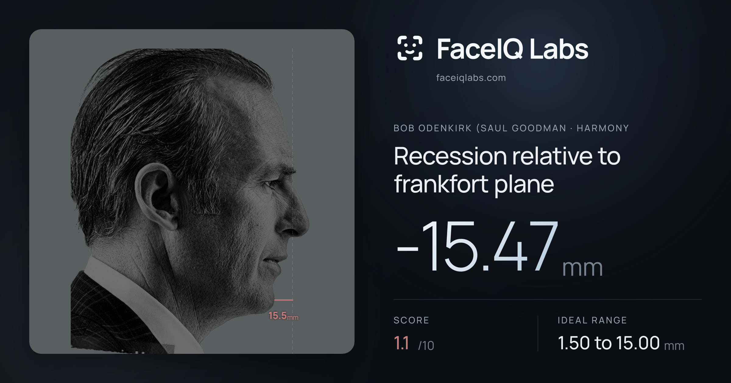 Bob Odenkirk (Saul Goodman Recession relative to frankfort plane: -15.47mm, drawn on the photo