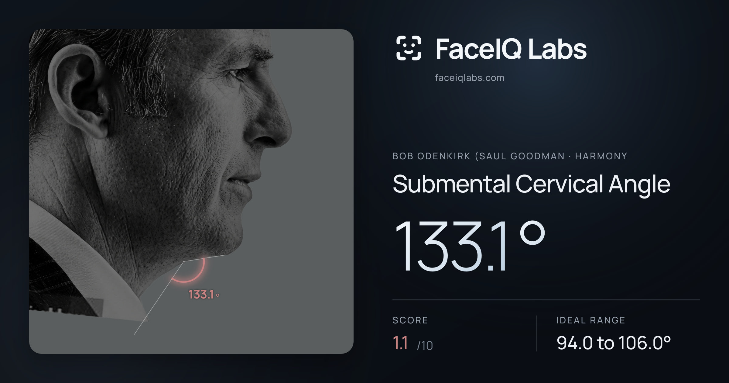 Bob Odenkirk (Saul Goodman Submental Cervical Angle: 133.1°, drawn on the photo