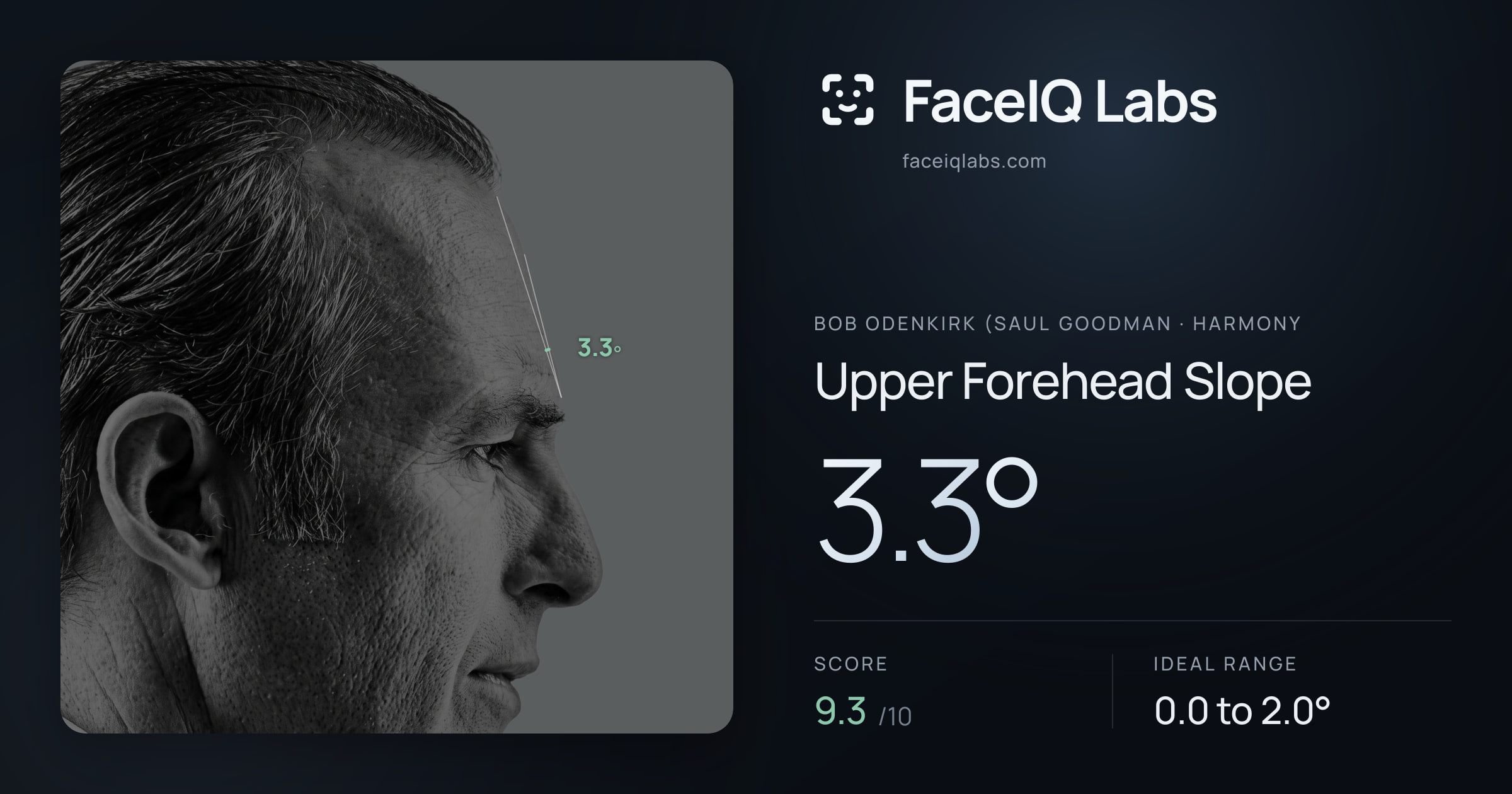 Bob Odenkirk (Saul Goodman Upper Forehead Slope: 3.3°, drawn on the photo