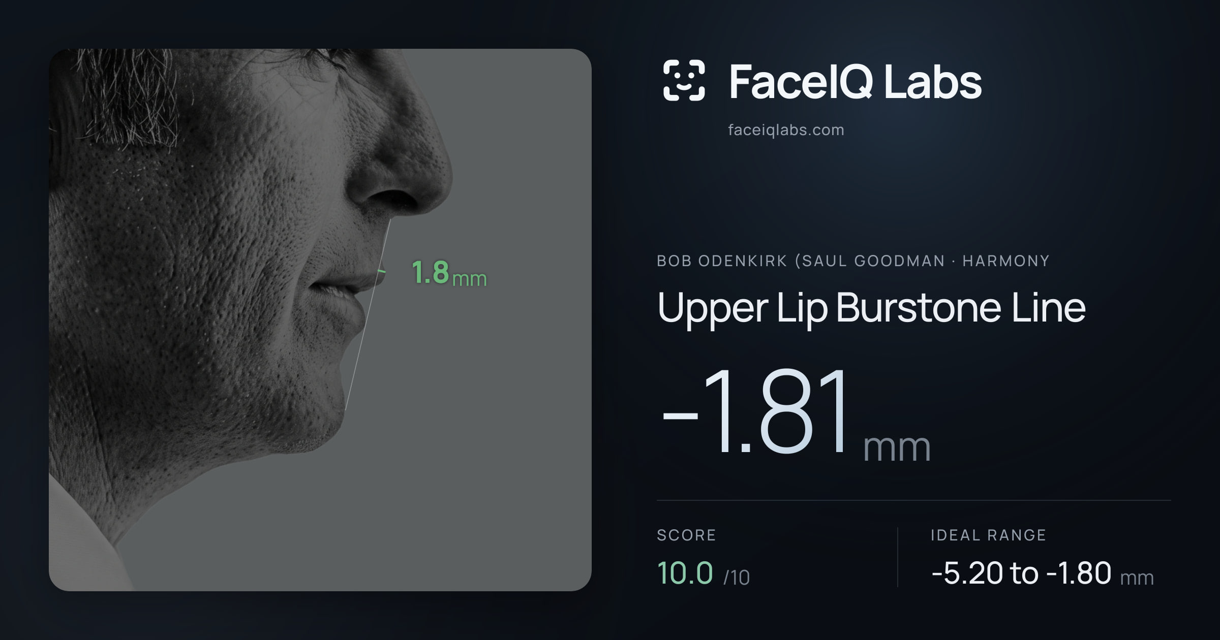 Bob Odenkirk (Saul Goodman Upper Lip Burstone Line: -1.81mm, drawn on the photo