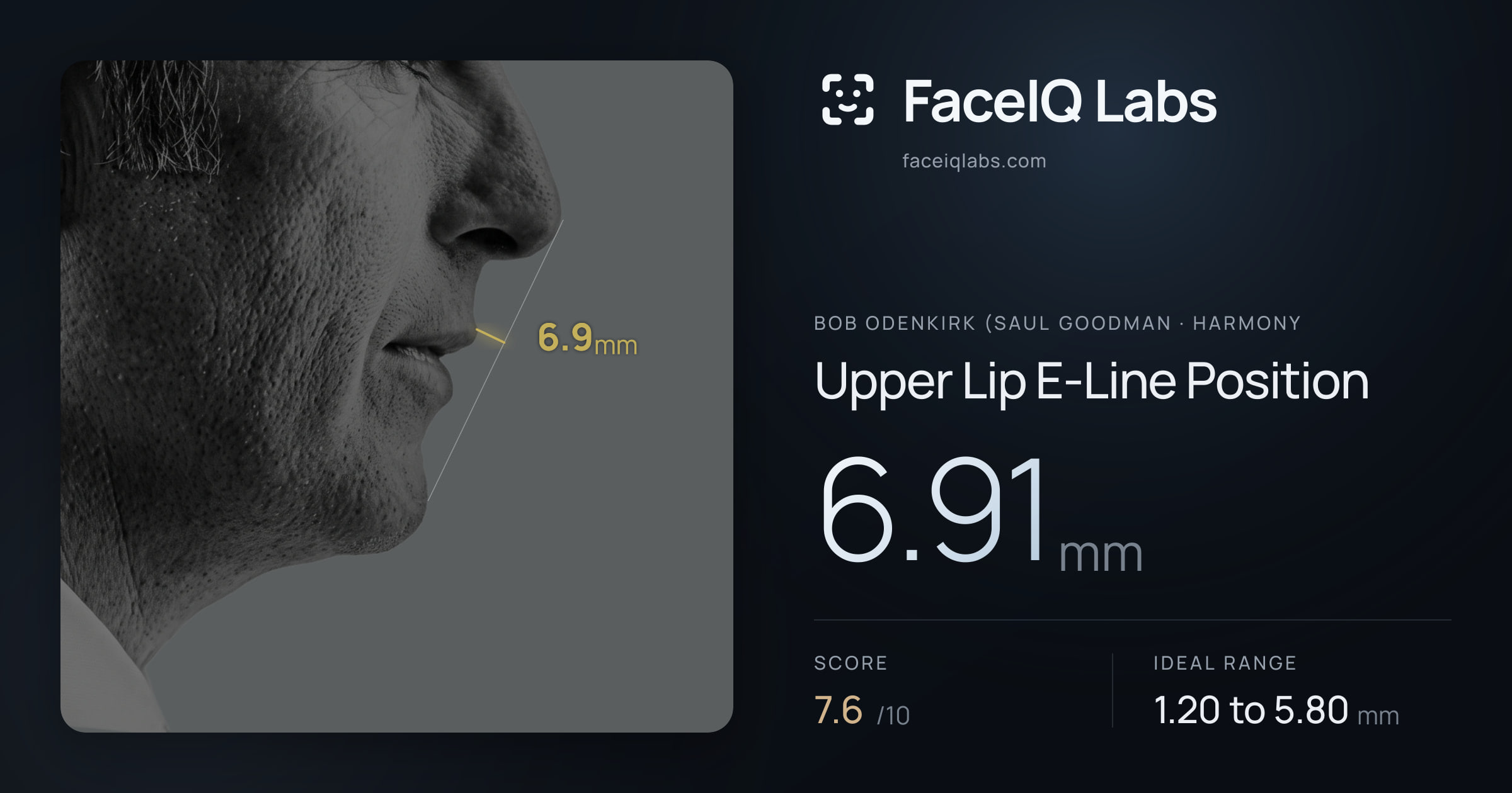 Bob Odenkirk (Saul Goodman Upper Lip E-Line Position: 6.91mm, drawn on the photo