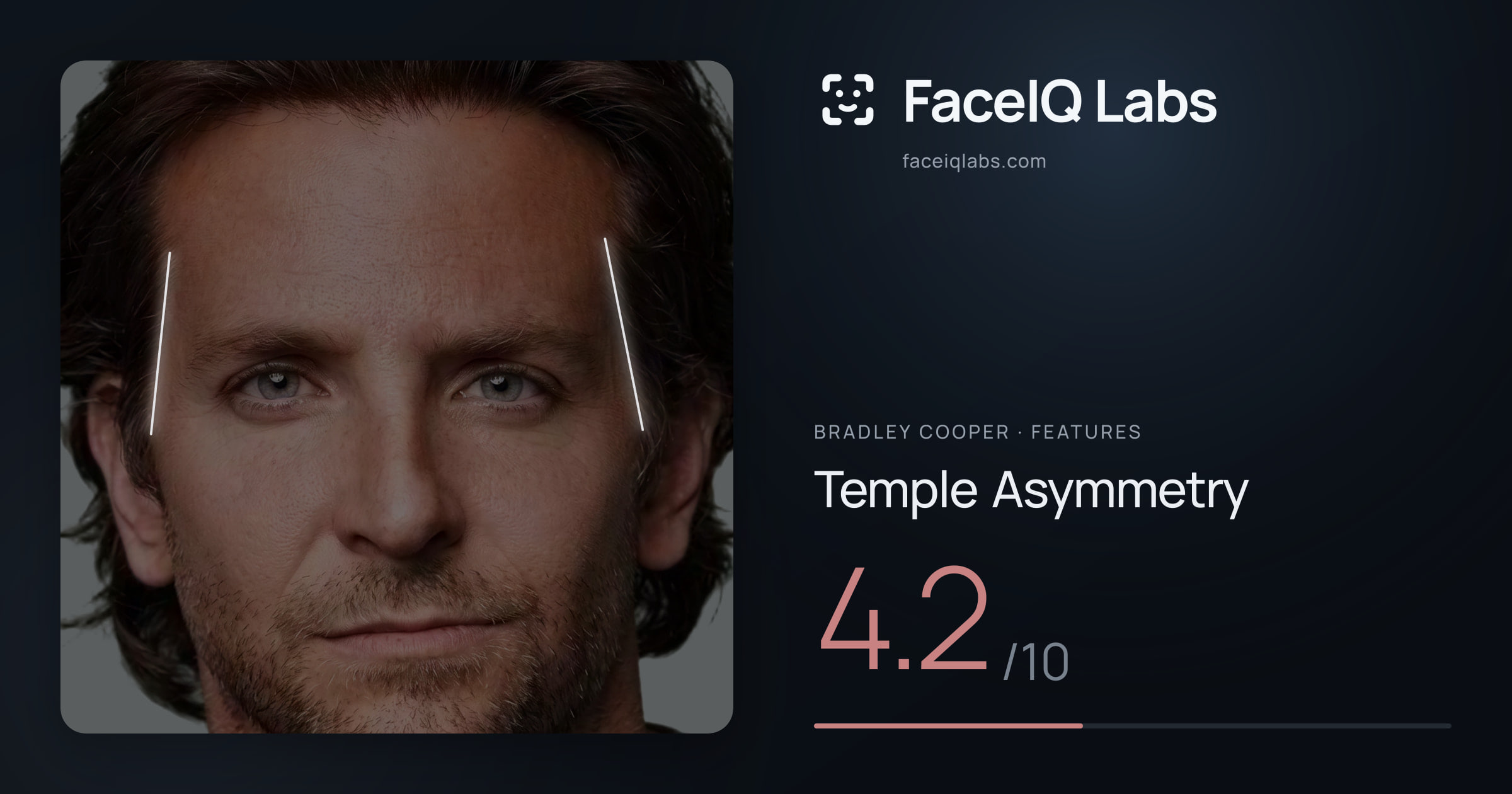 Bradley Cooper Temple Asymmetry: 4.2/10, drawn on the photo