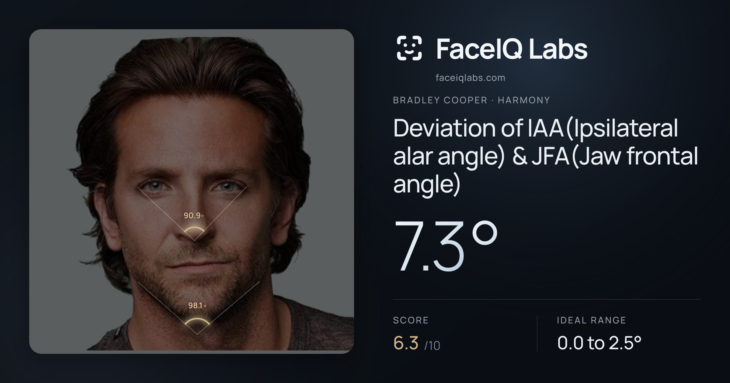 Bradley Cooper Deviation of IAA(Ipsilateral alar angle) & JFA(Jaw frontal angle): 7.3°, drawn on the photo