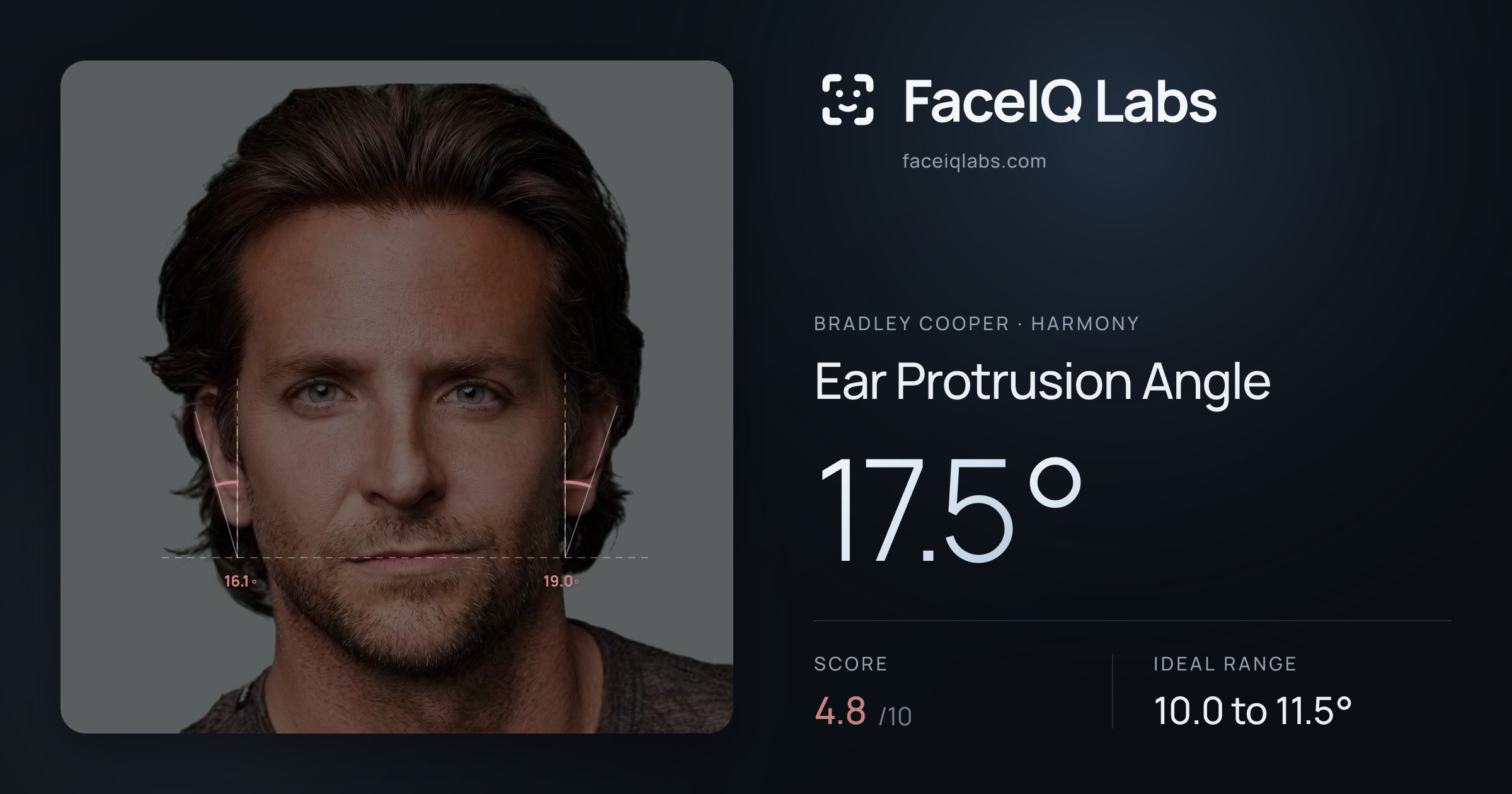 Bradley Cooper Ear Protrusion Angle: 17.5°, drawn on the photo