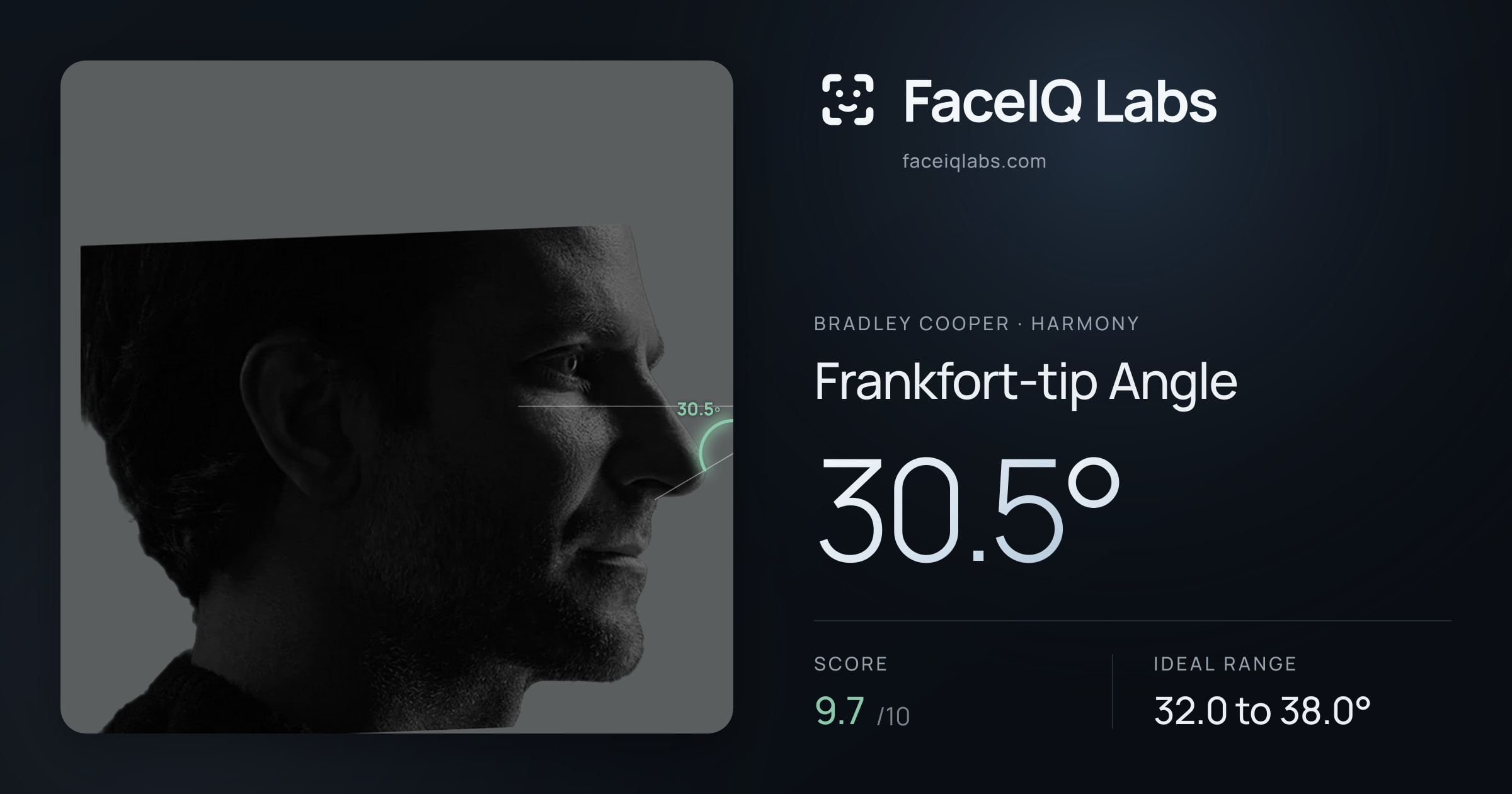Bradley Cooper Frankfort-tip Angle: 30.5°, drawn on the photo