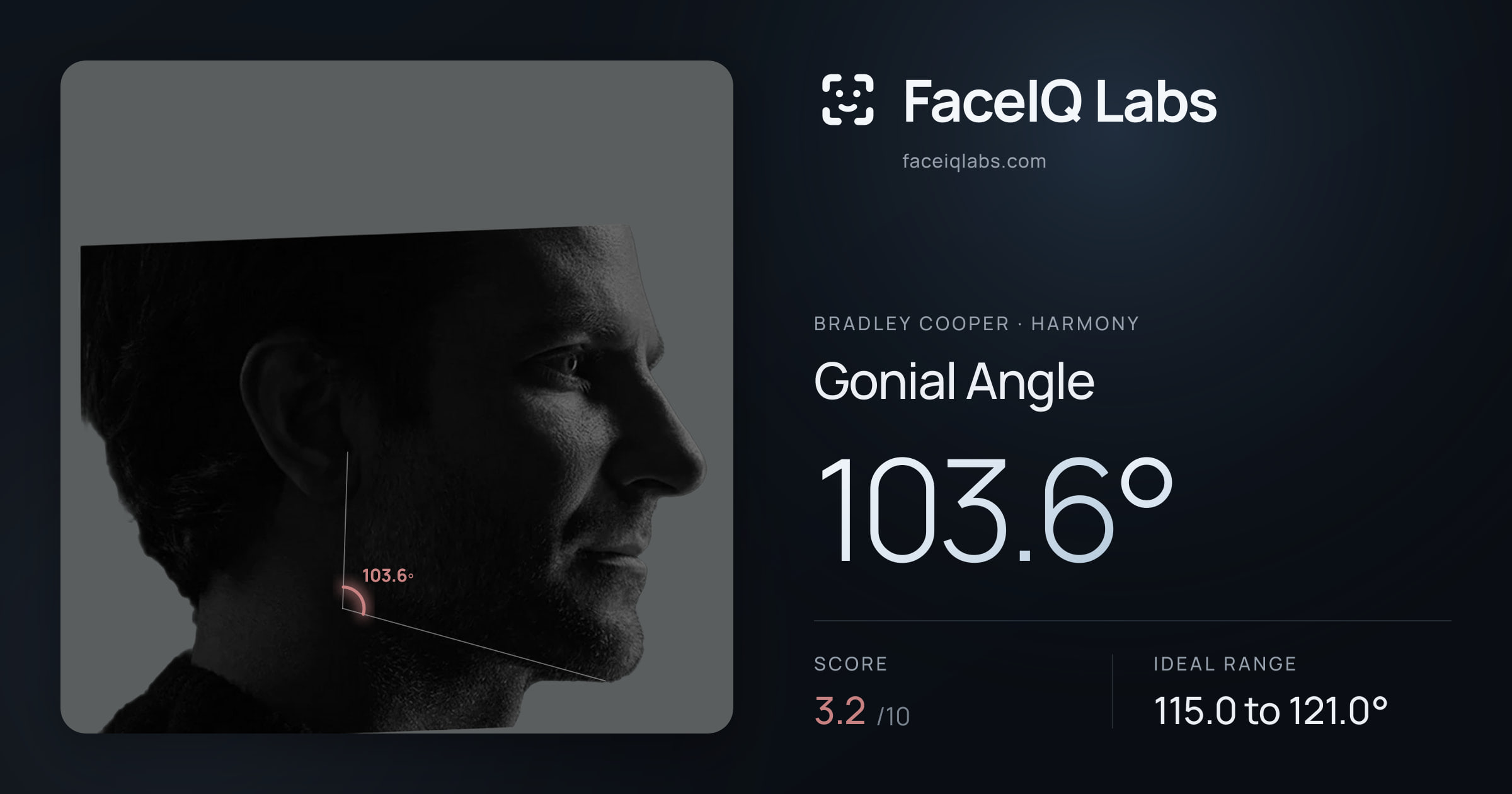 Bradley Cooper Gonial Angle: 103.6°, drawn on the photo