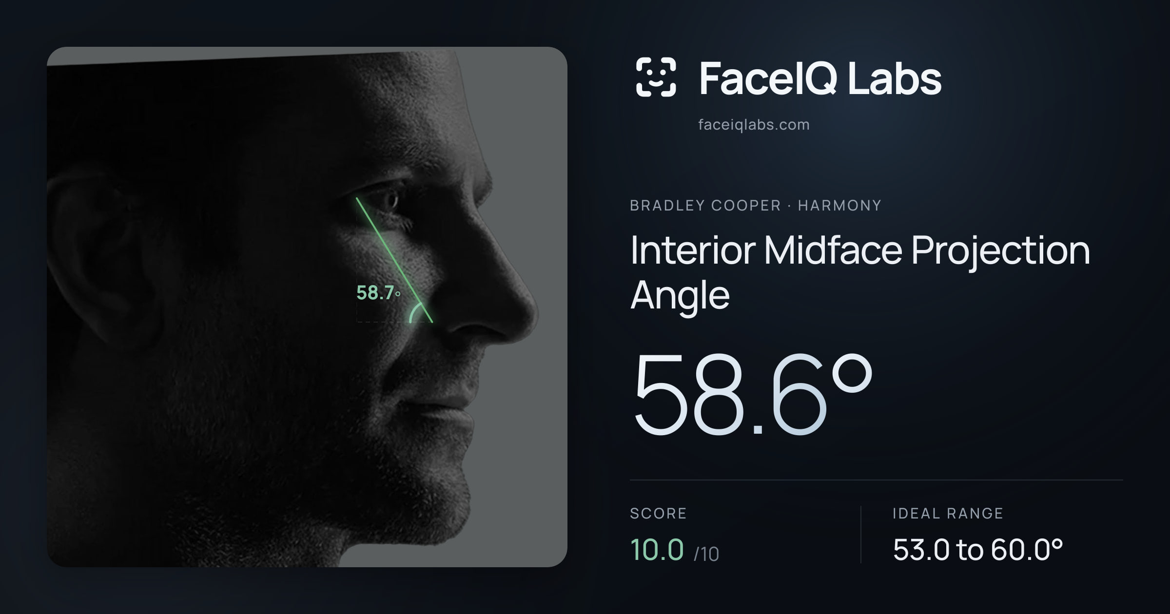 Bradley Cooper Interior Midface Projection Angle: 58.6°, drawn on the photo