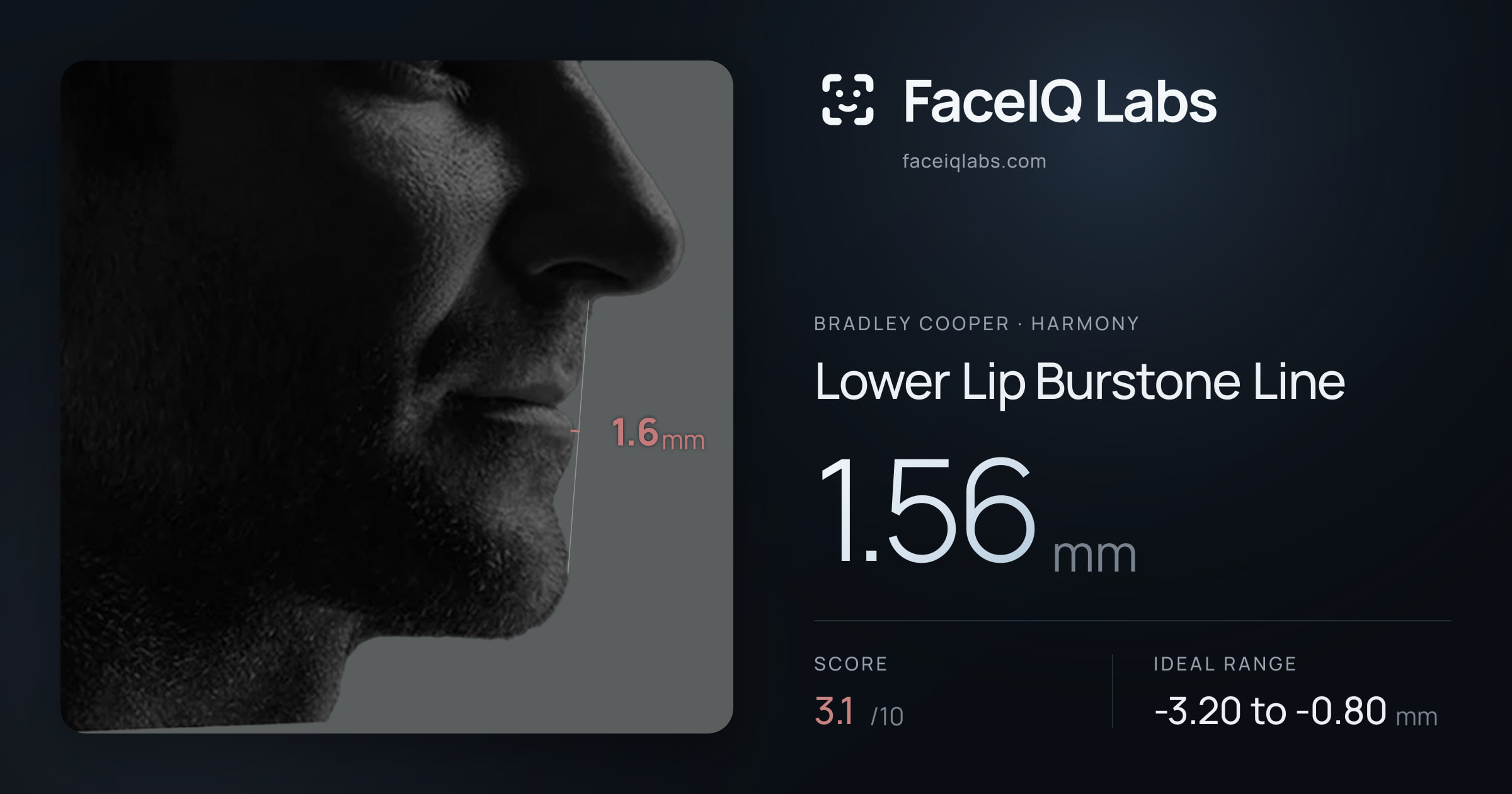 Bradley Cooper Lower Lip Burstone Line: 1.56mm, drawn on the photo