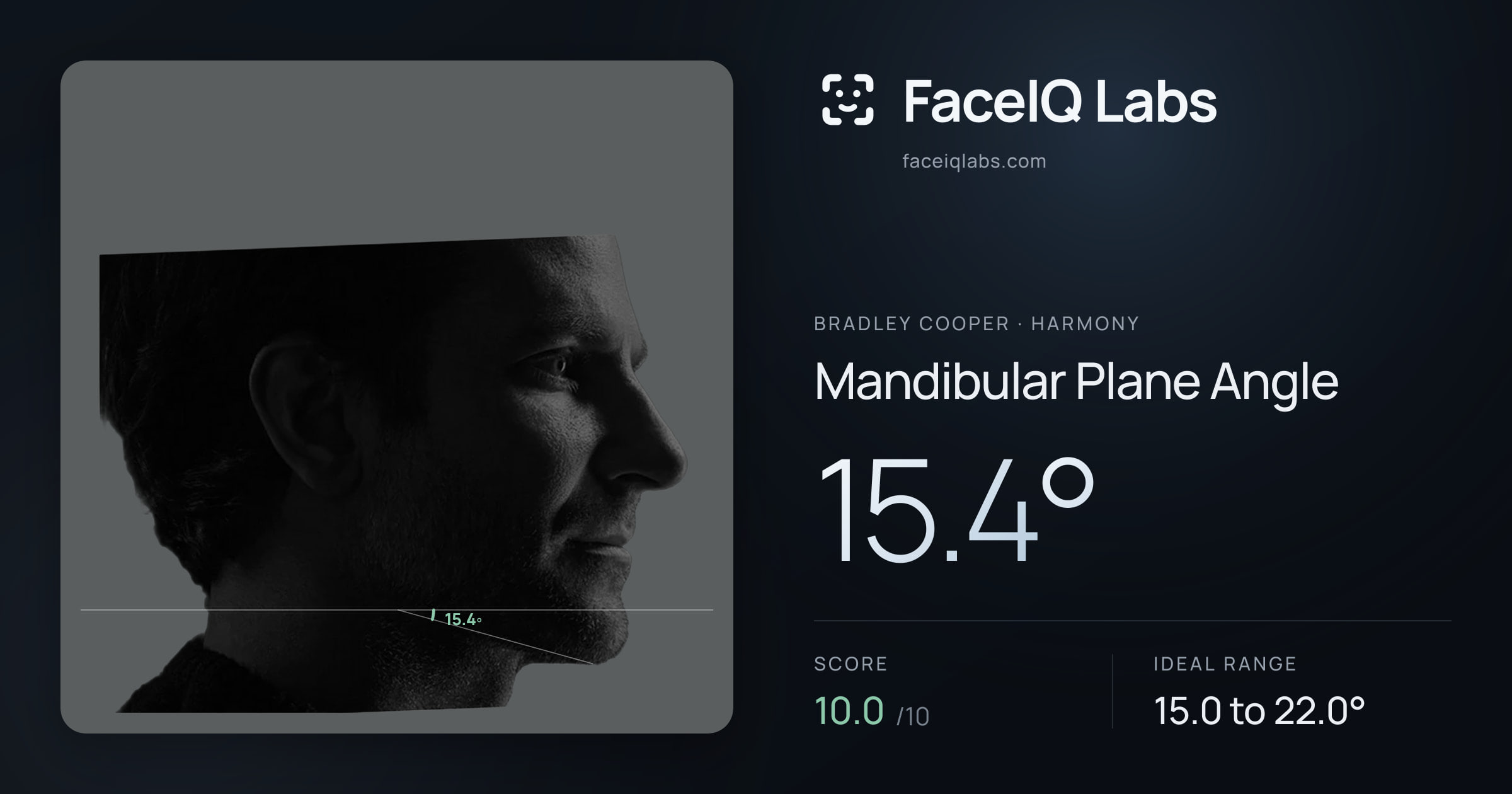 Bradley Cooper Mandibular Plane Angle: 15.4°, drawn on the photo