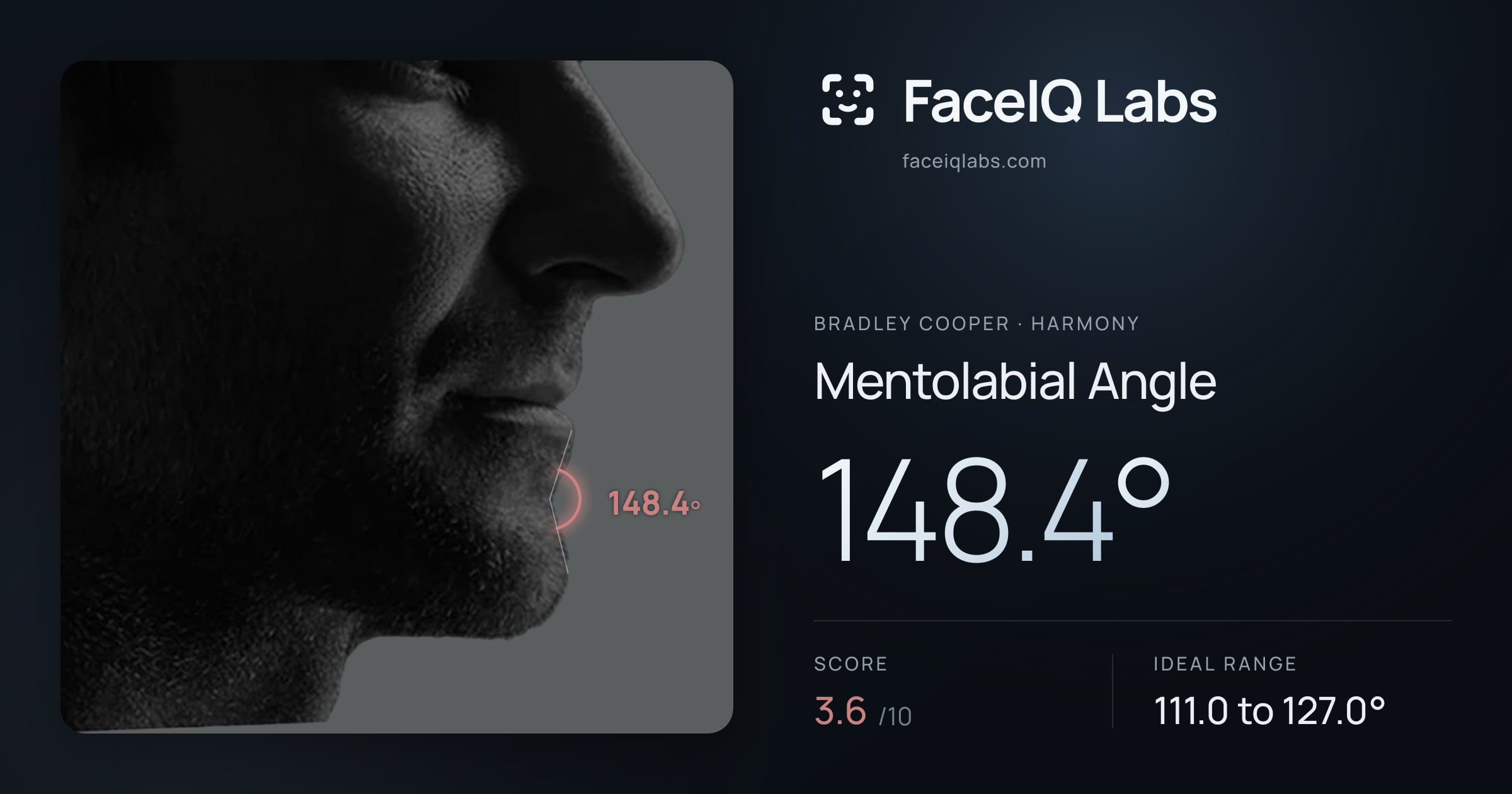 Bradley Cooper Mentolabial Angle: 148.4°, drawn on the photo