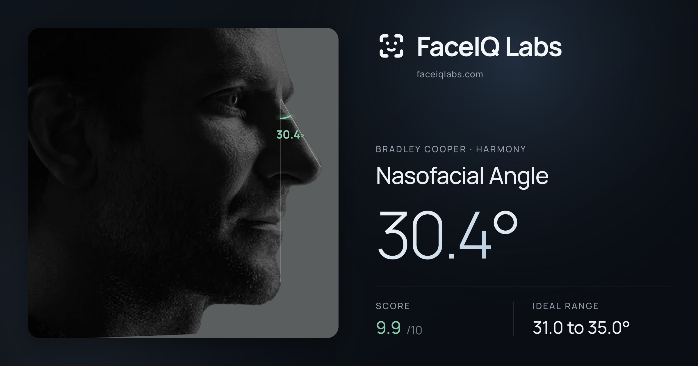 Bradley Cooper Nasofacial Angle: 30.4°, drawn on the photo