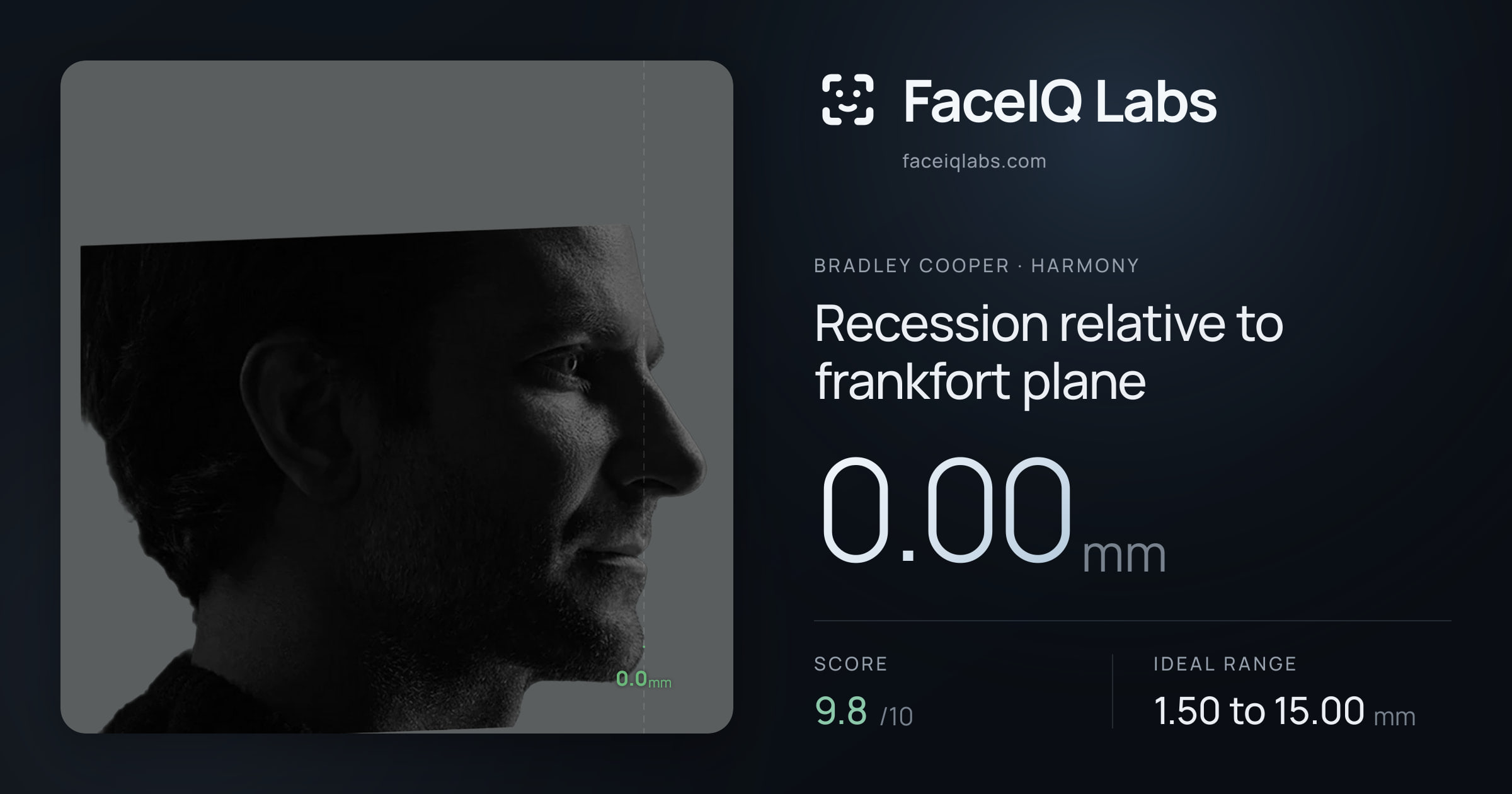 Bradley Cooper Recession relative to frankfort plane: 0.00mm, drawn on the photo