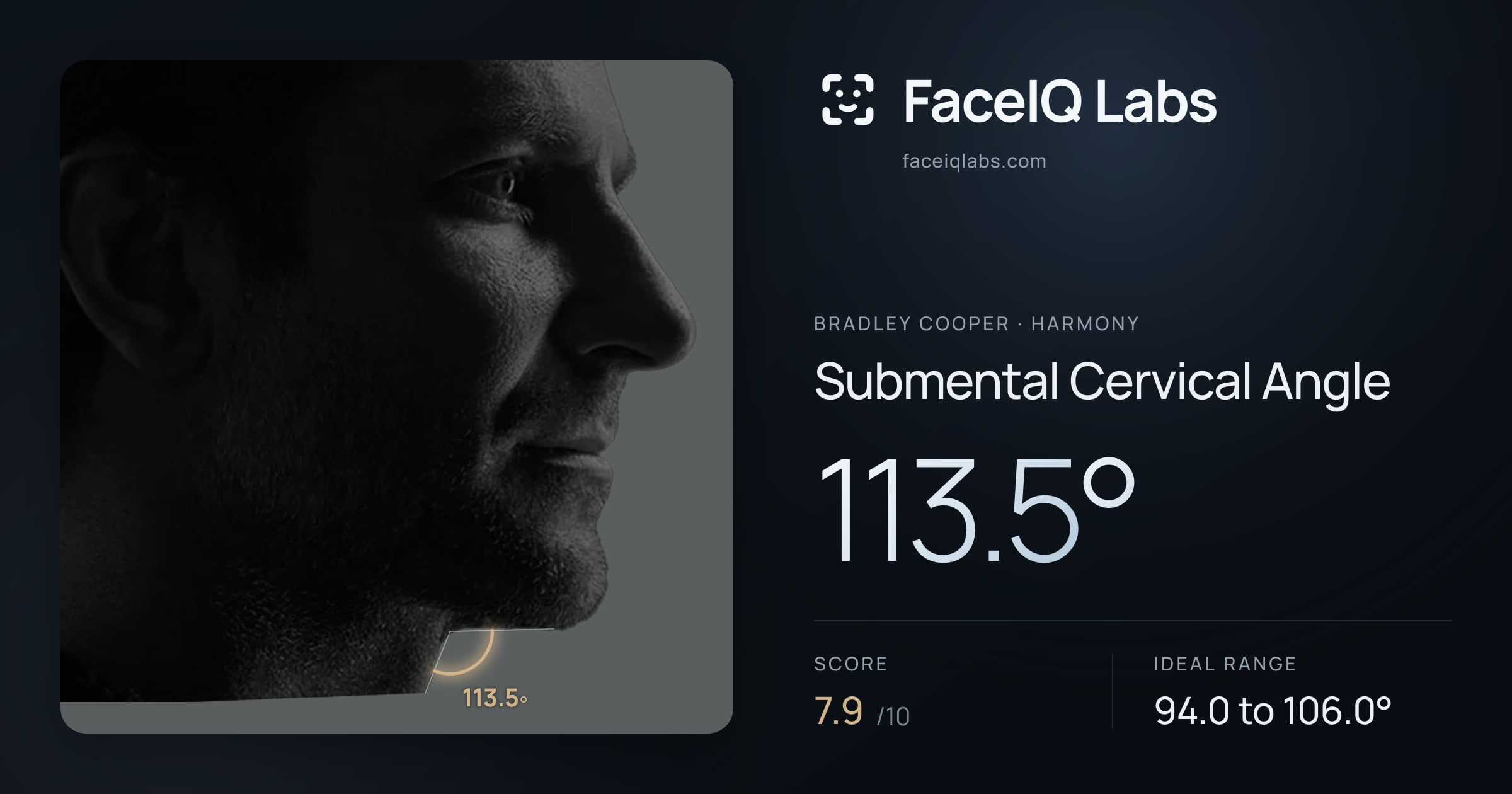 Bradley Cooper Submental Cervical Angle: 113.5°, drawn on the photo