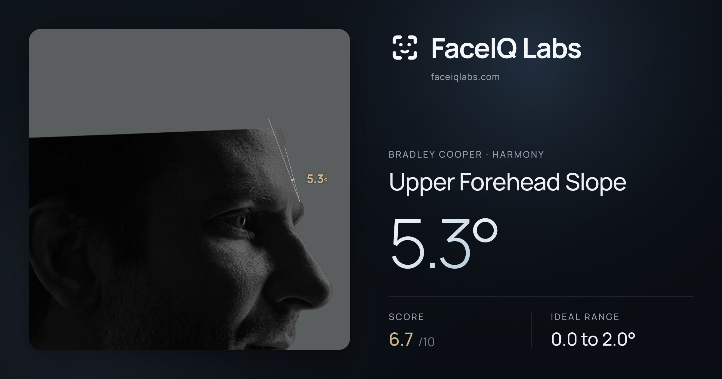 Bradley Cooper Upper Forehead Slope: 5.3°, drawn on the photo