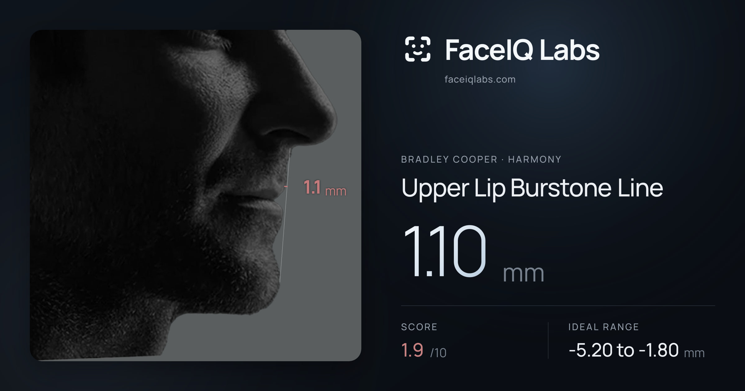 Bradley Cooper Upper Lip Burstone Line: 1.10mm, drawn on the photo