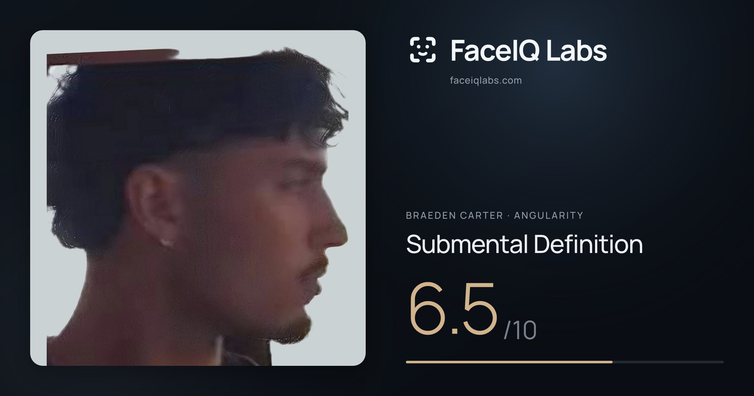 Braeden Carter Submental Definition: 6.5/10, drawn on the photo