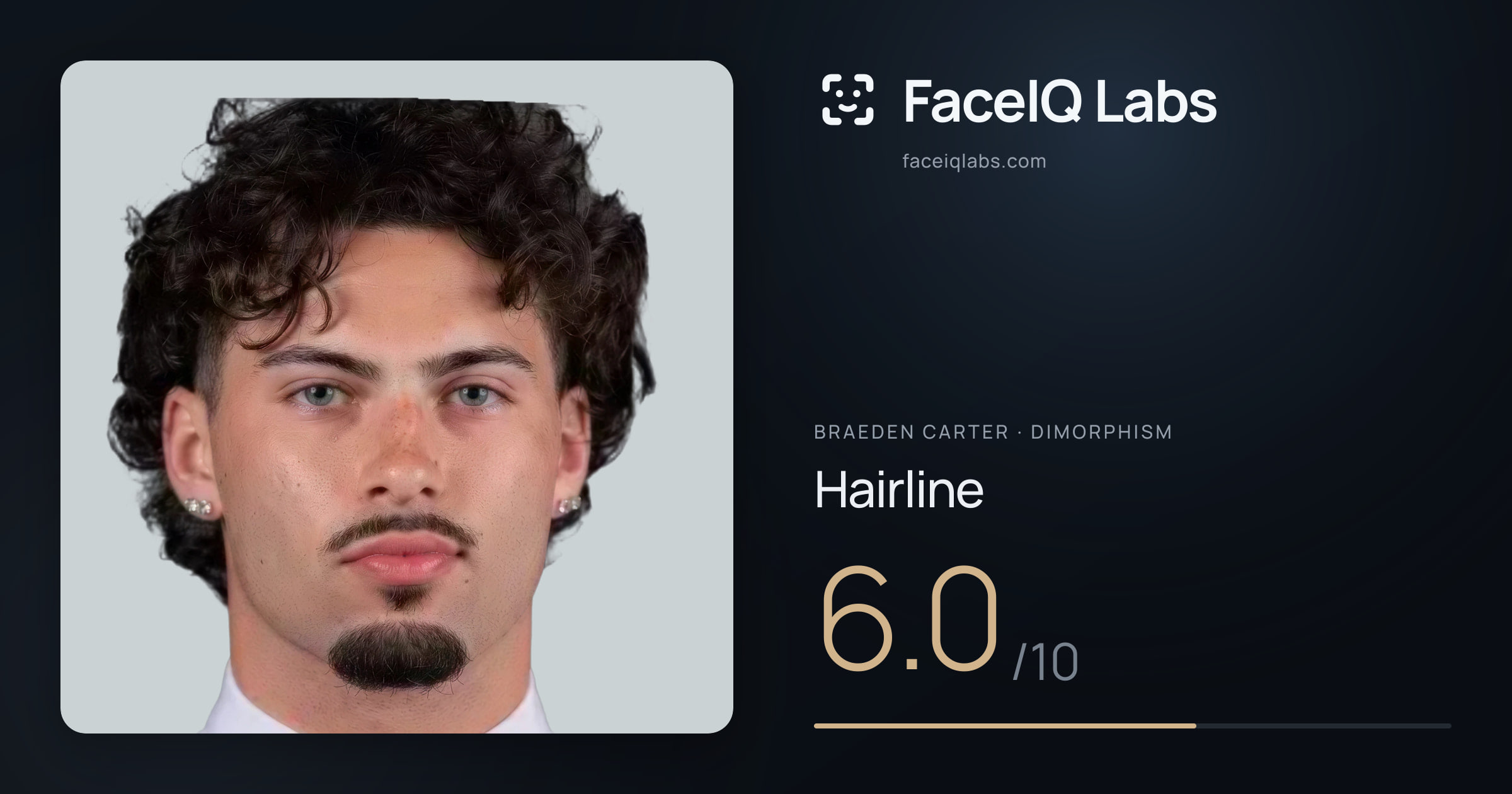 Braeden Carter Hairline: 6.0/10, drawn on the photo