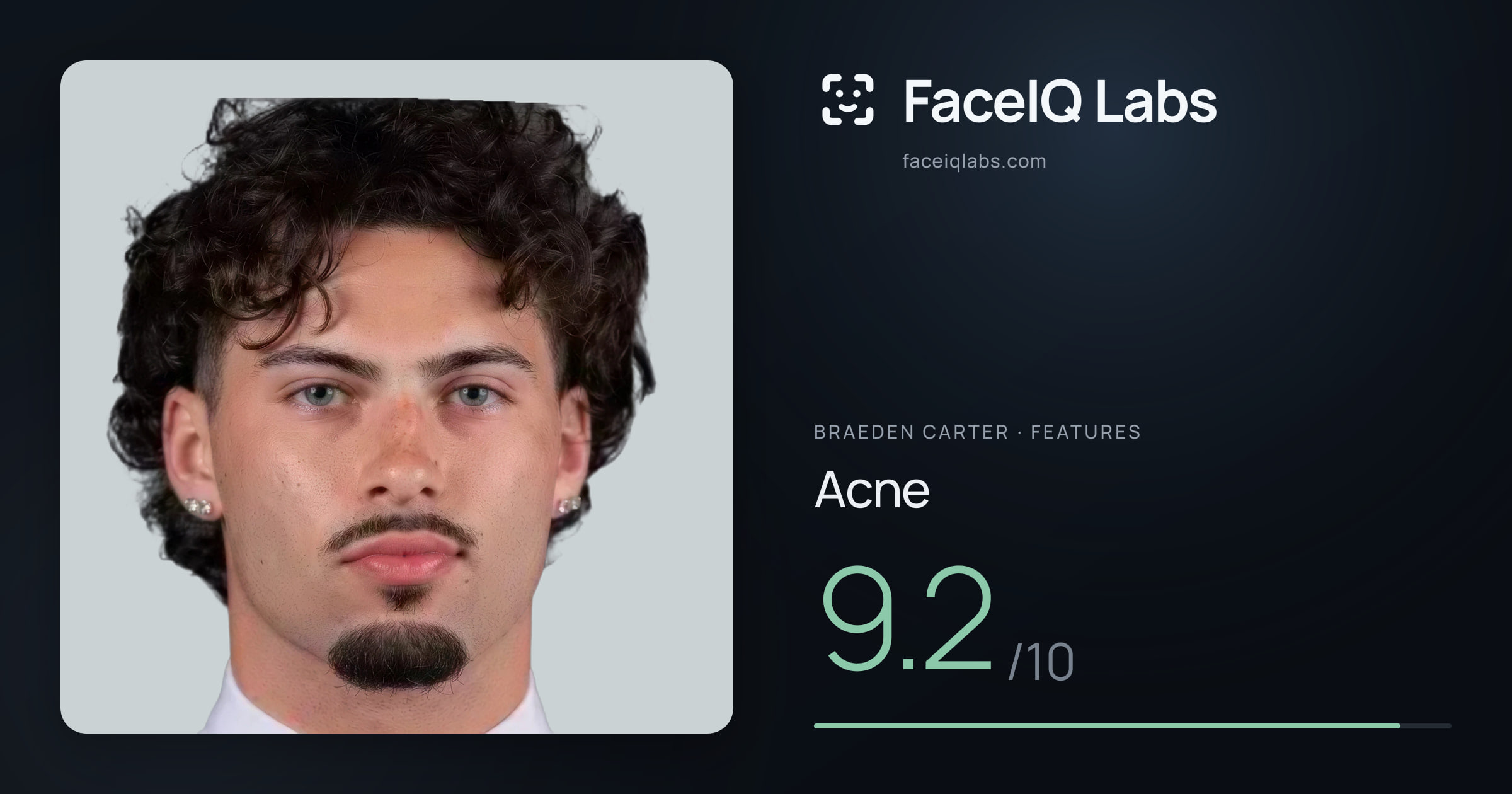 Braeden Carter Acne: 9.2/10, drawn on the photo