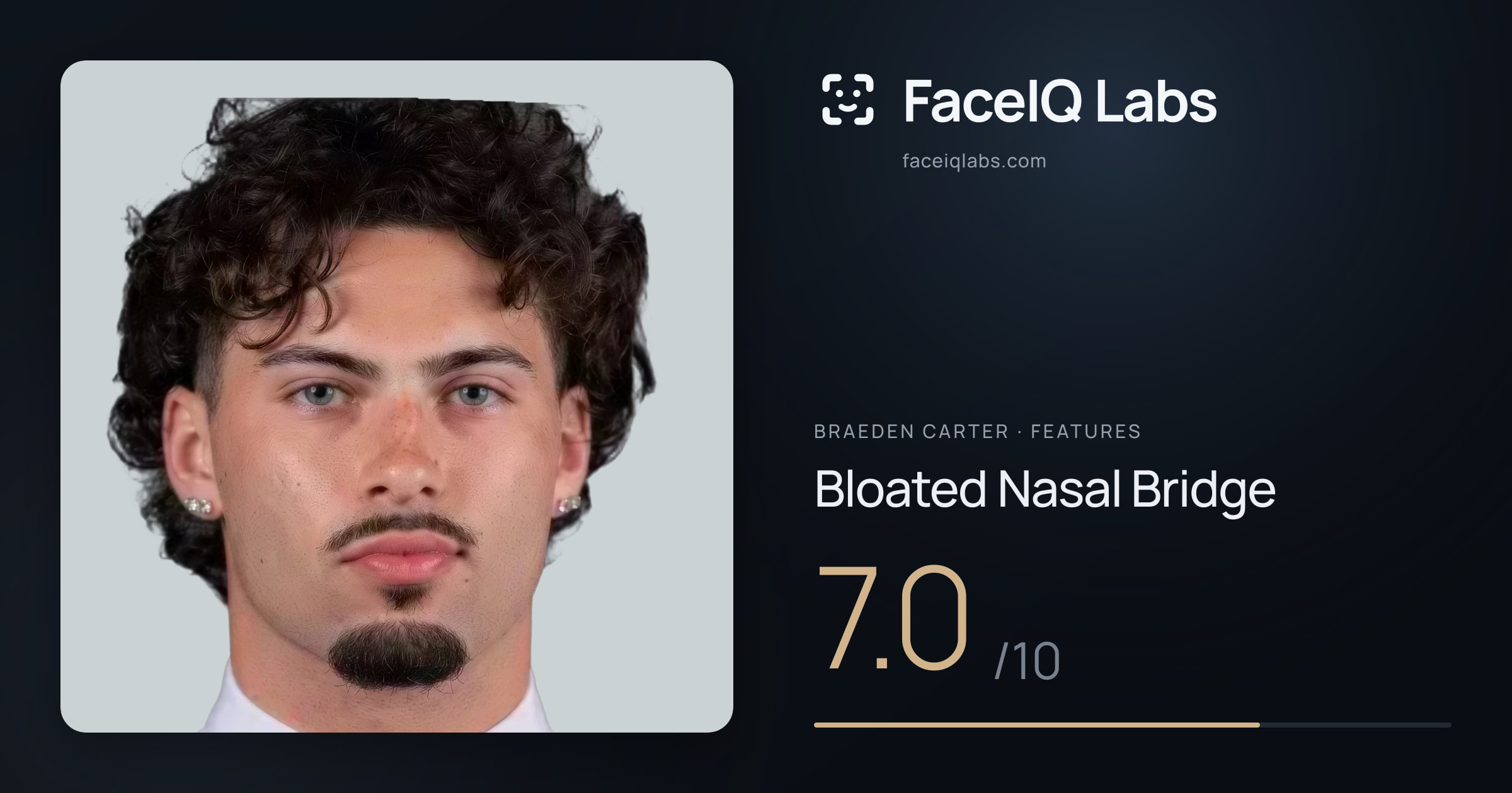 Braeden Carter Bloated Nasal Bridge: 7.0/10, drawn on the photo