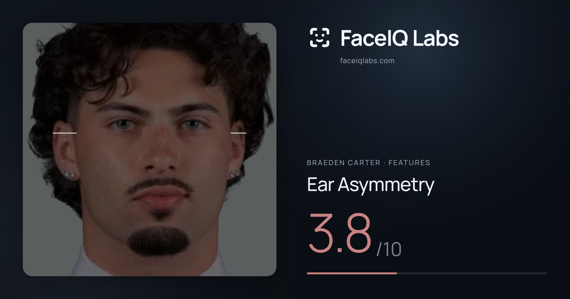 Braeden Carter Ear Asymmetry: 3.8/10, drawn on the photo