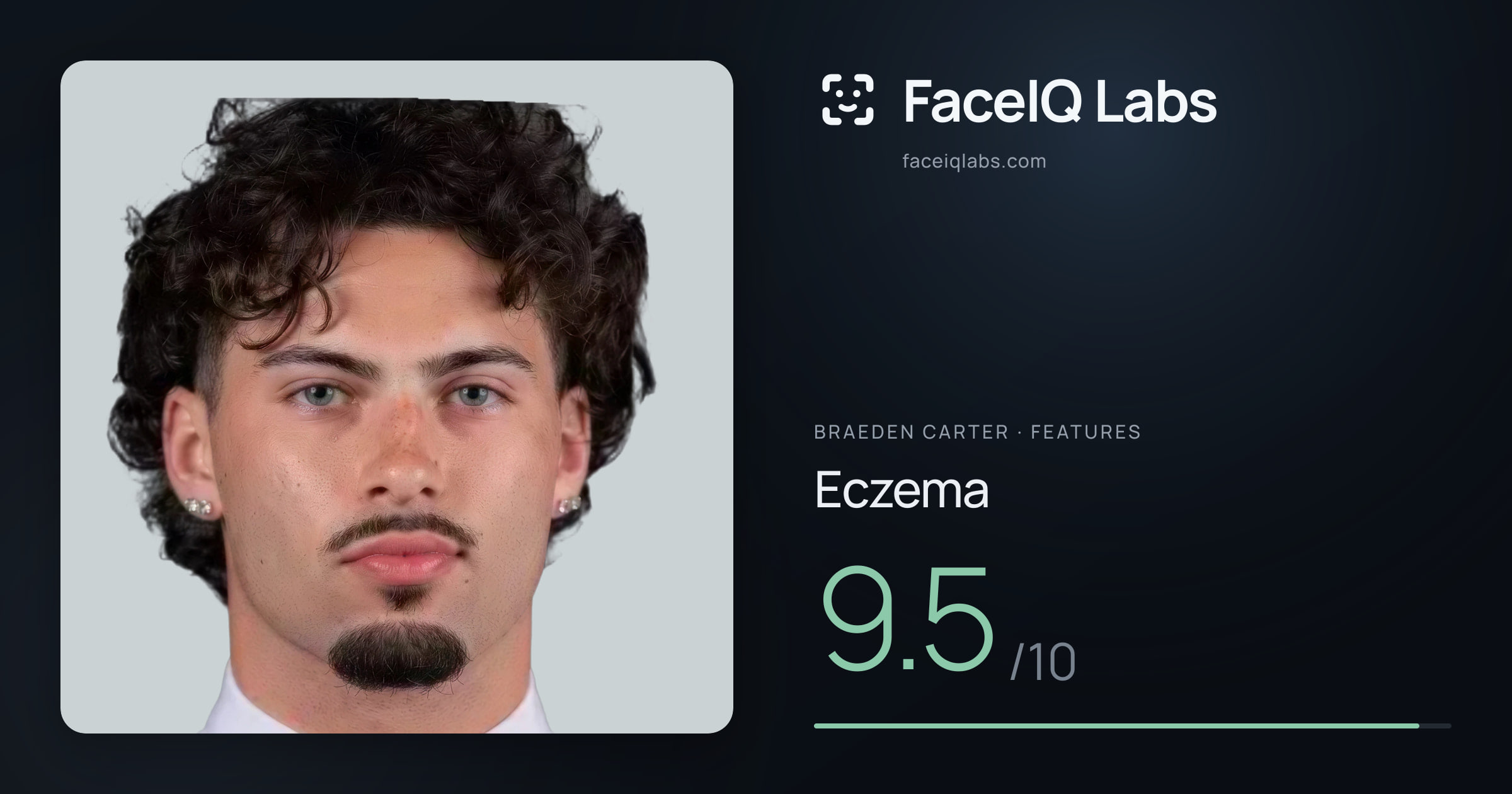 Braeden Carter Eczema: 9.5/10, drawn on the photo