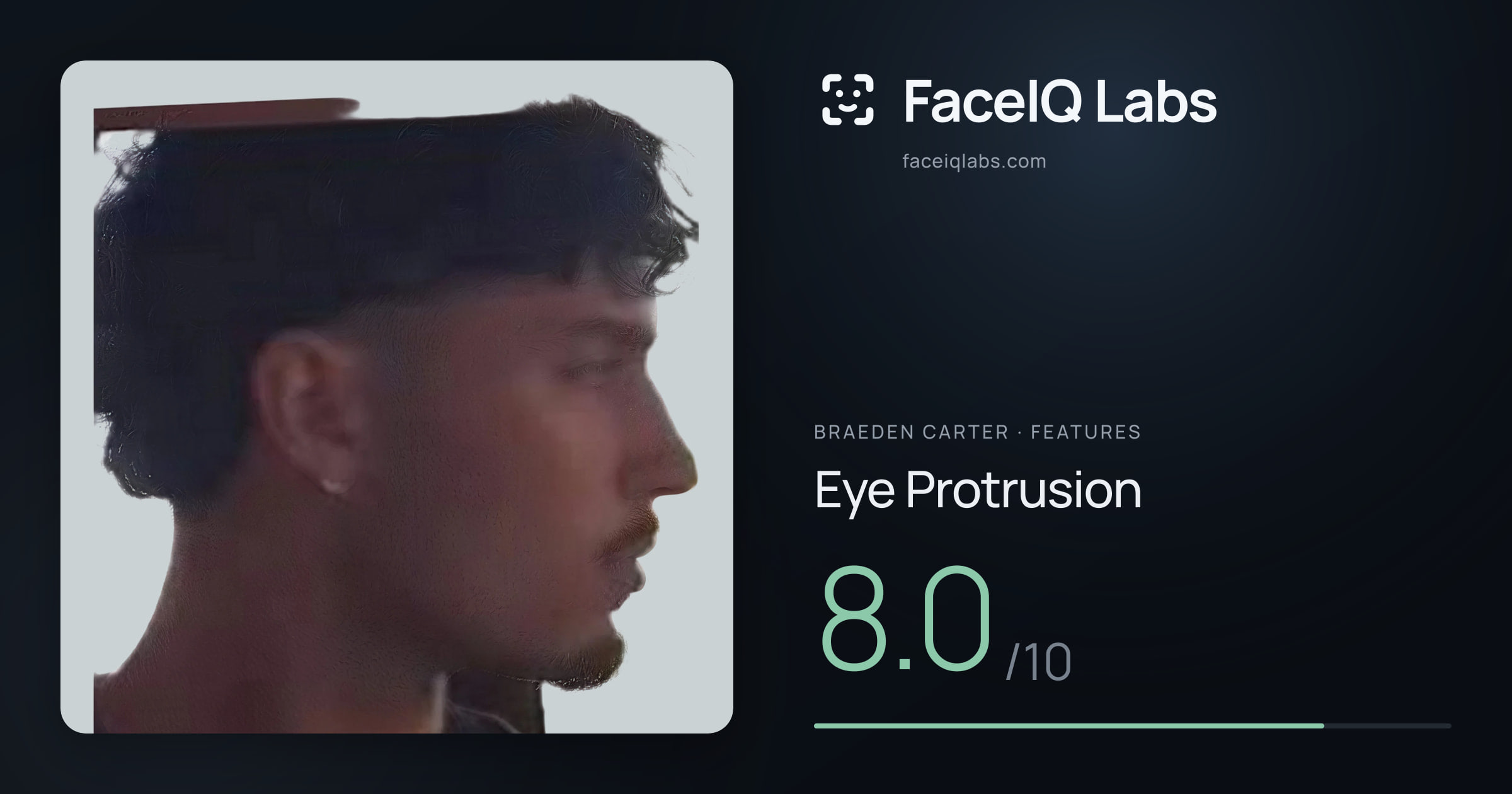 Braeden Carter Eye Protrusion: 8.0/10, drawn on the photo