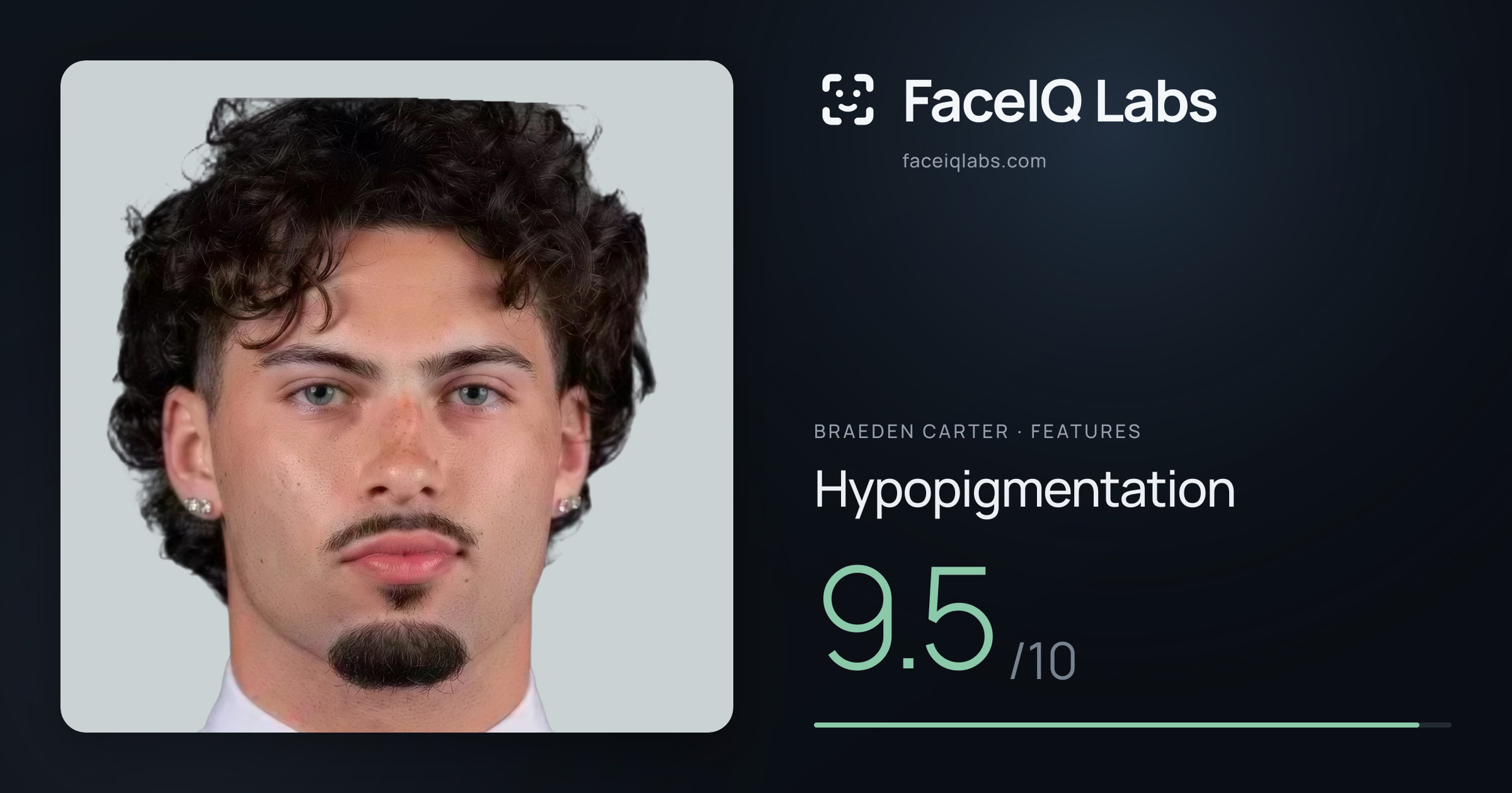 Braeden Carter Hypopigmentation: 9.5/10, drawn on the photo