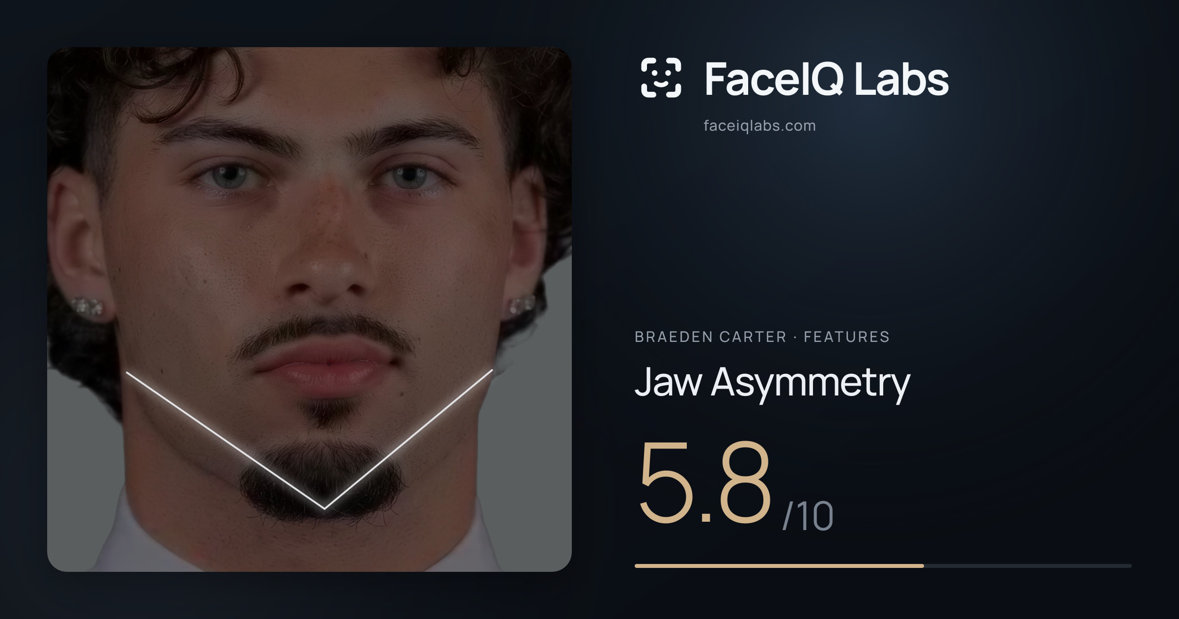 Braeden Carter Jaw Asymmetry: 5.8/10, drawn on the photo