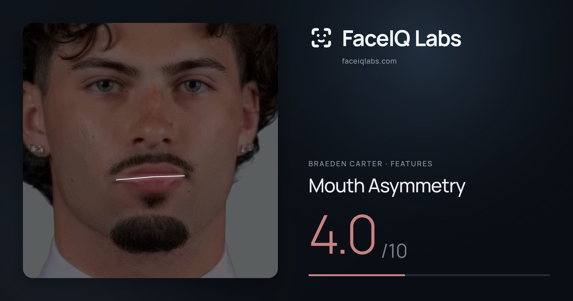 Braeden Carter Mouth Asymmetry: 4.0/10, drawn on the photo