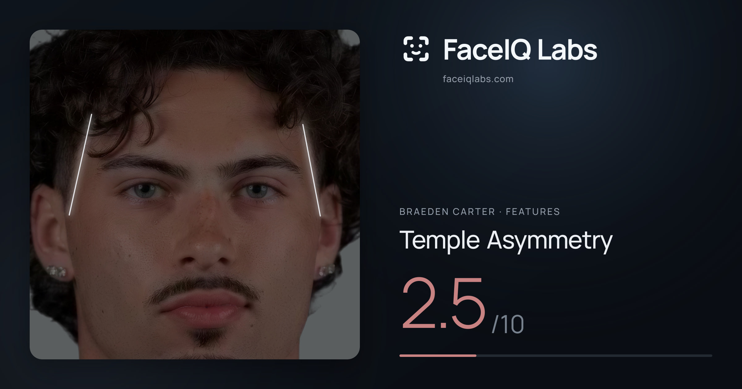 Braeden Carter Temple Asymmetry: 2.5/10, drawn on the photo