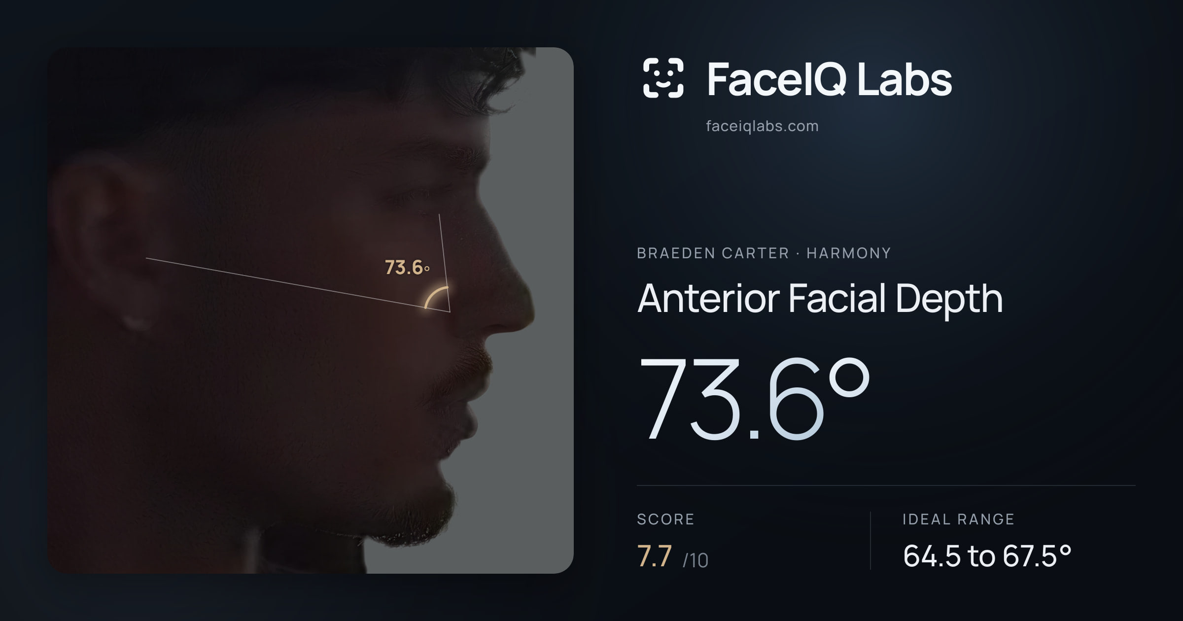 Braeden Carter Anterior Facial Depth: 73.6°, drawn on the photo
