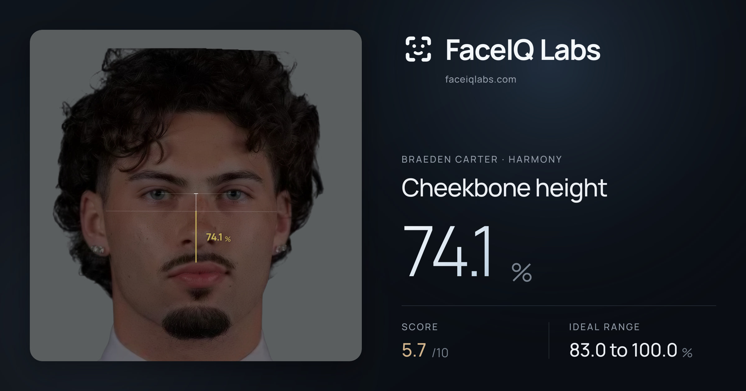 Braeden Carter Cheekbone height: 74.1%, drawn on the photo